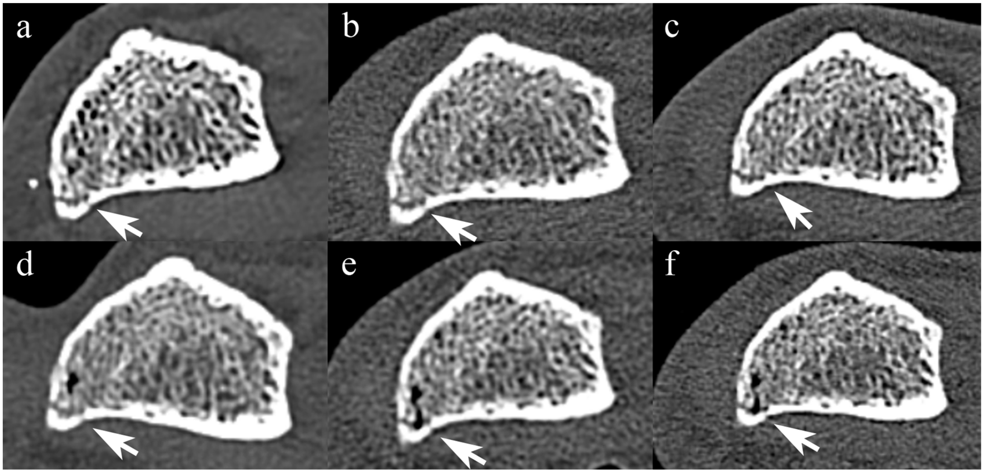 Diagnostics 14 00350 g004