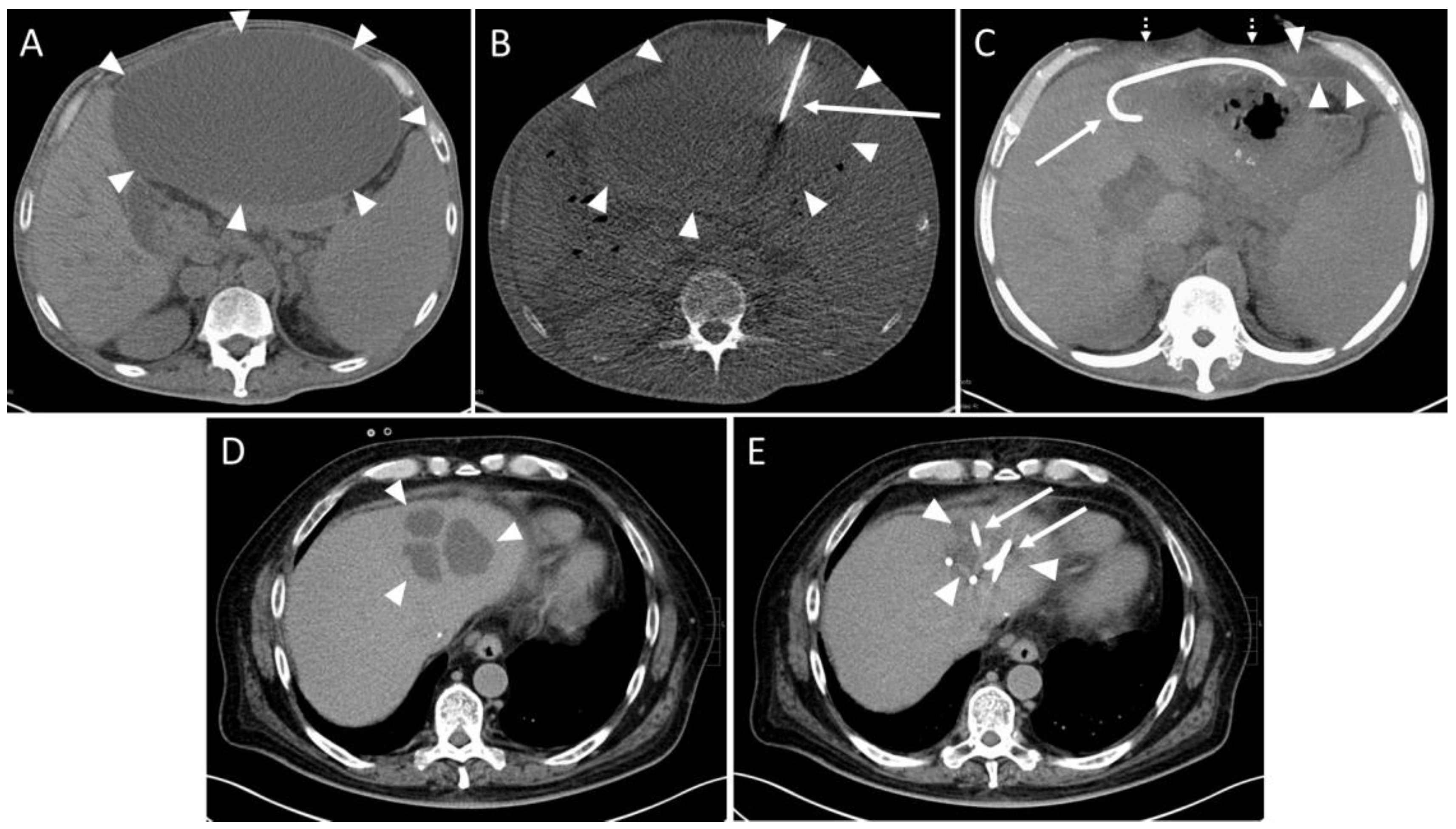 Diagnostics 14 00353 g002