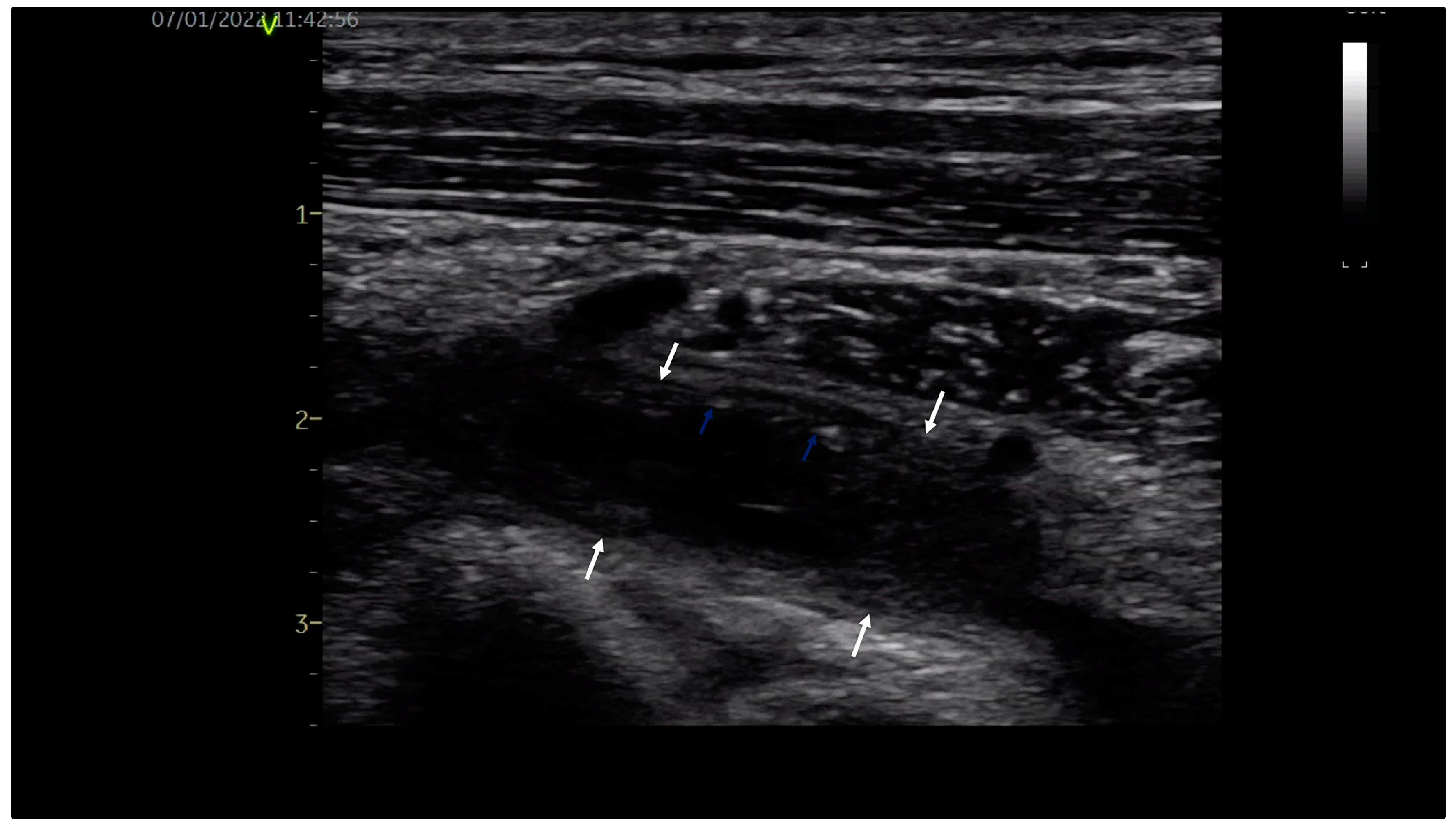Diagnostics 14 00354 g001