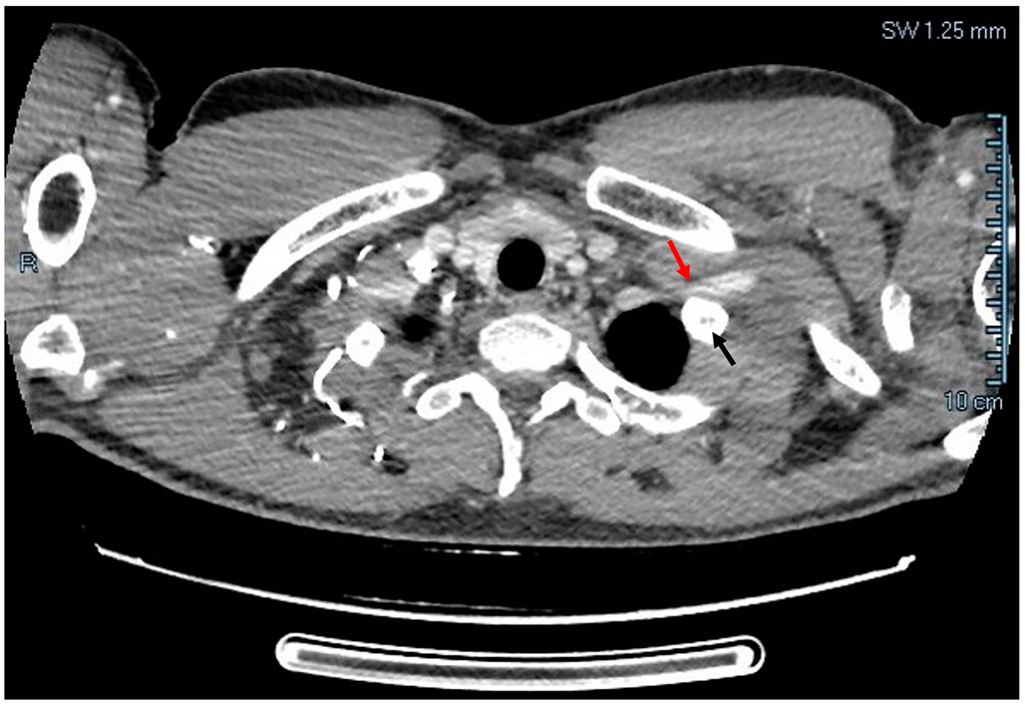 Diagnostics 14 00354 g002