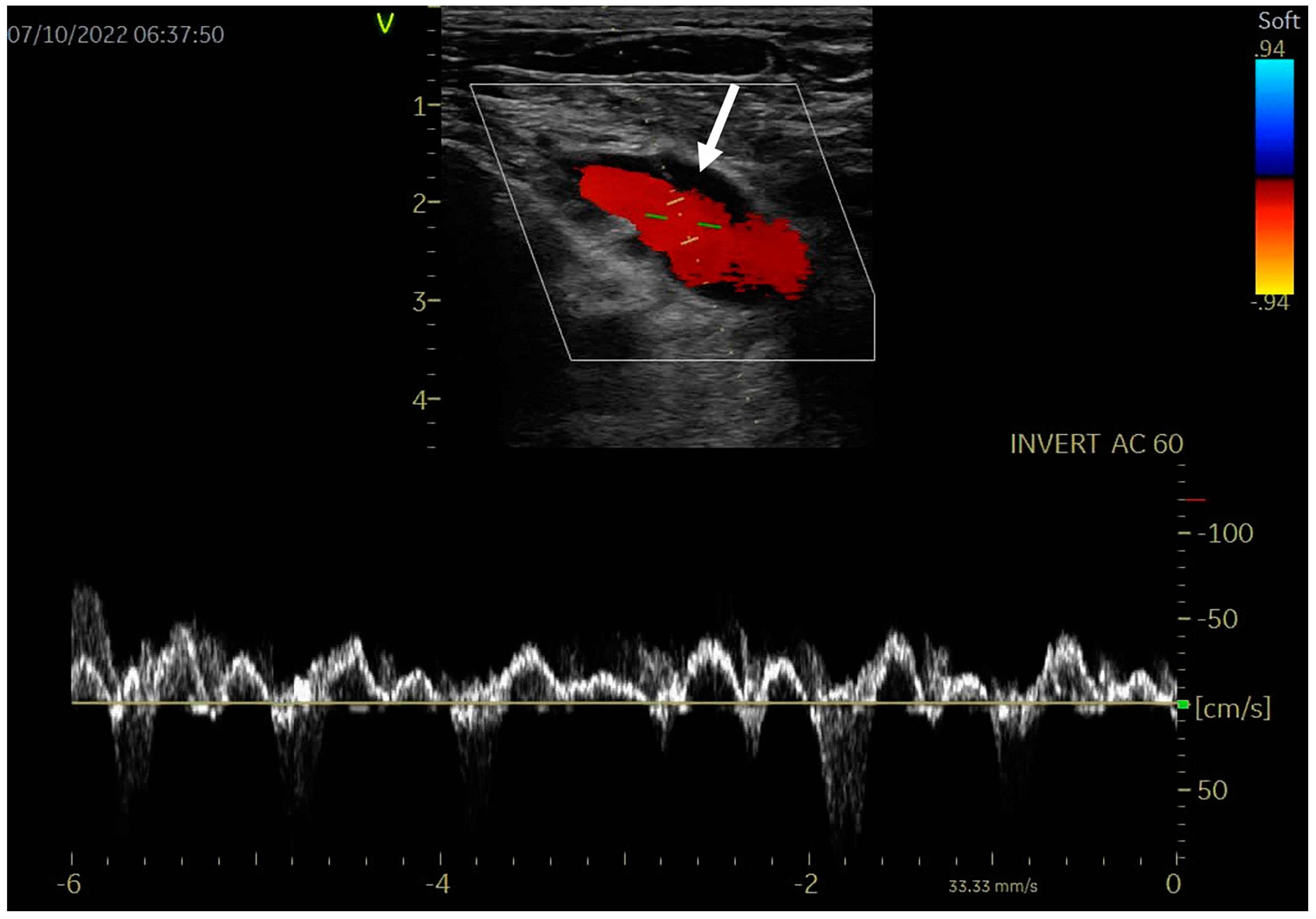 Diagnostics 14 00354 g003