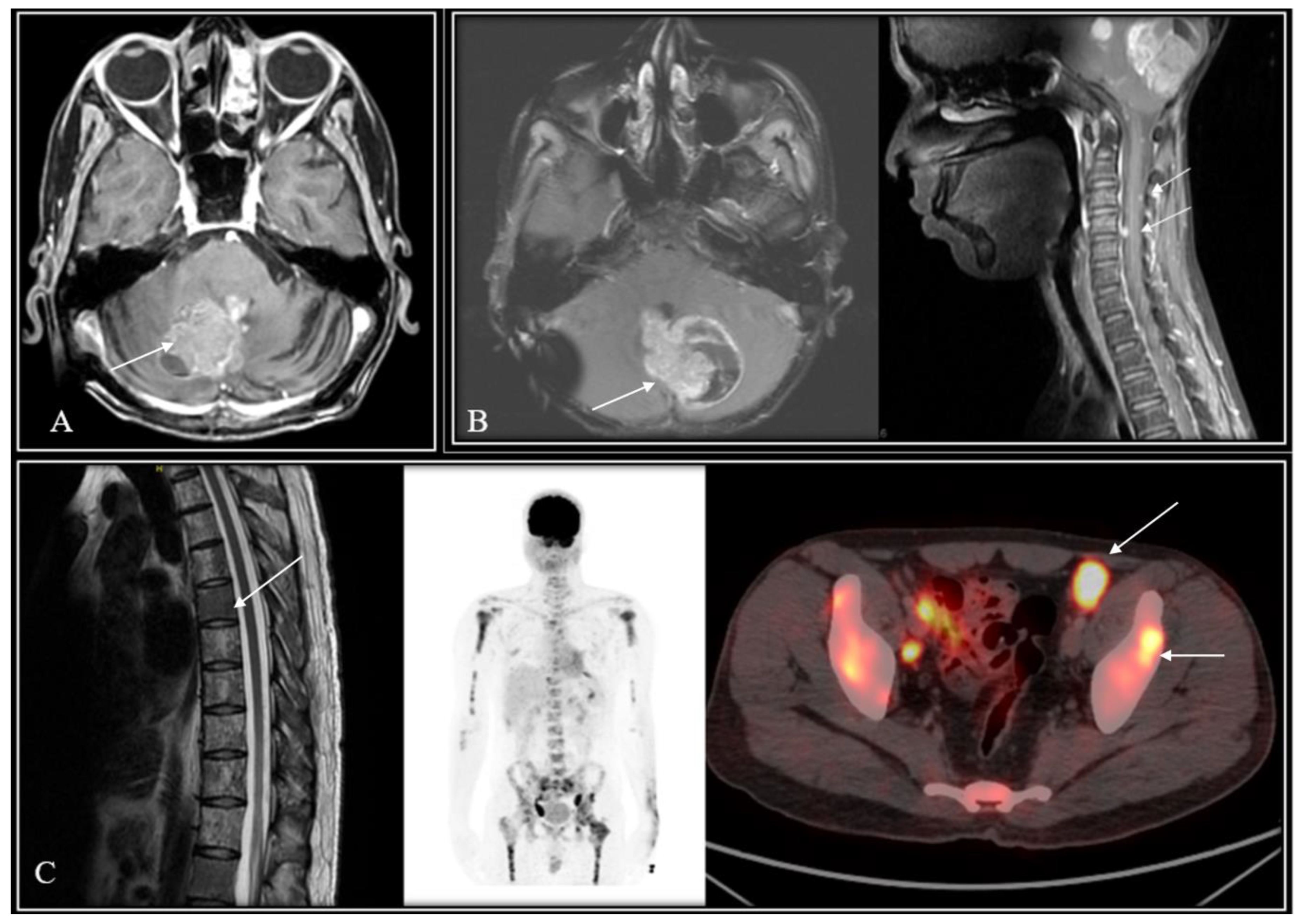 Diagnostics 14 00358 g002