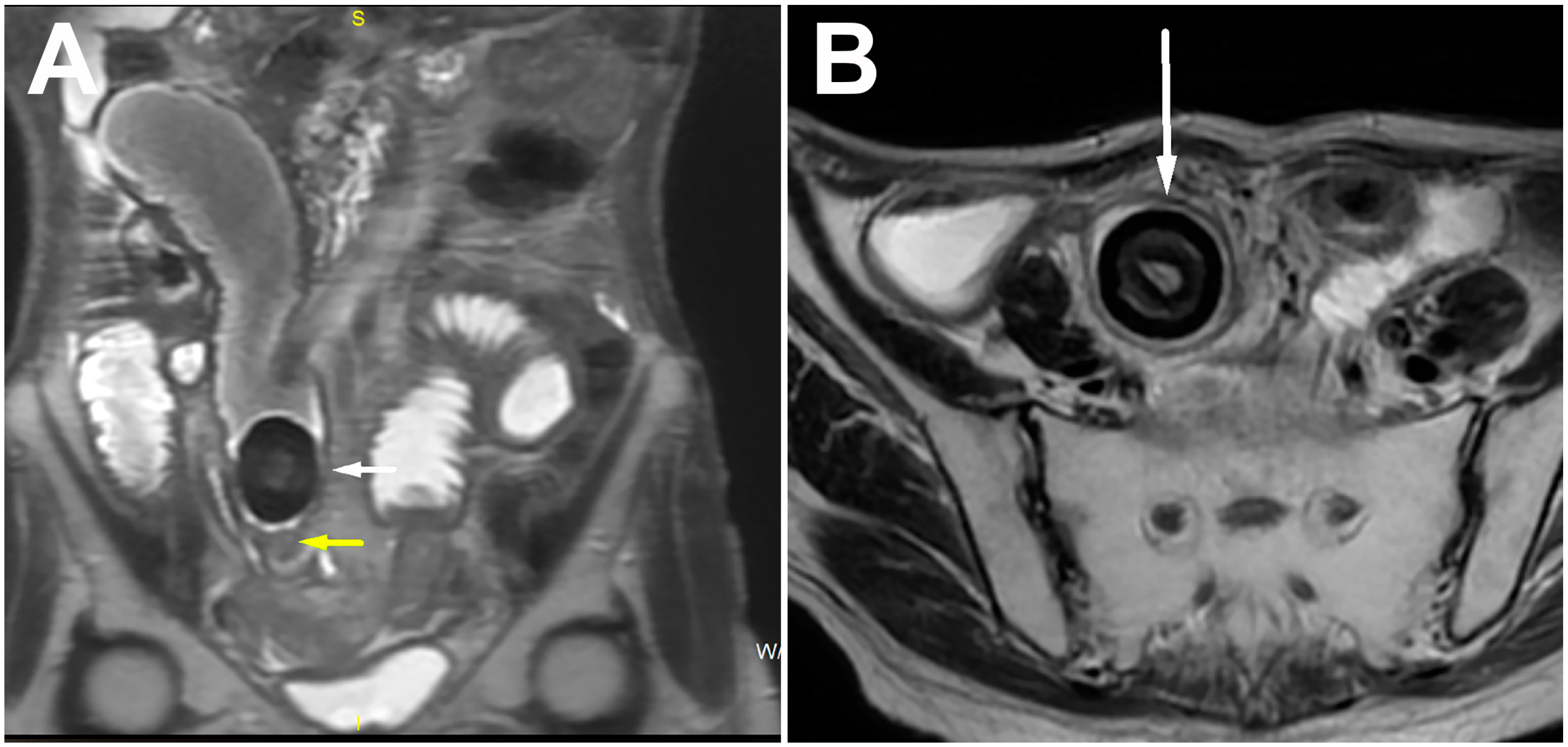 Diagnostics 14 00360 g003