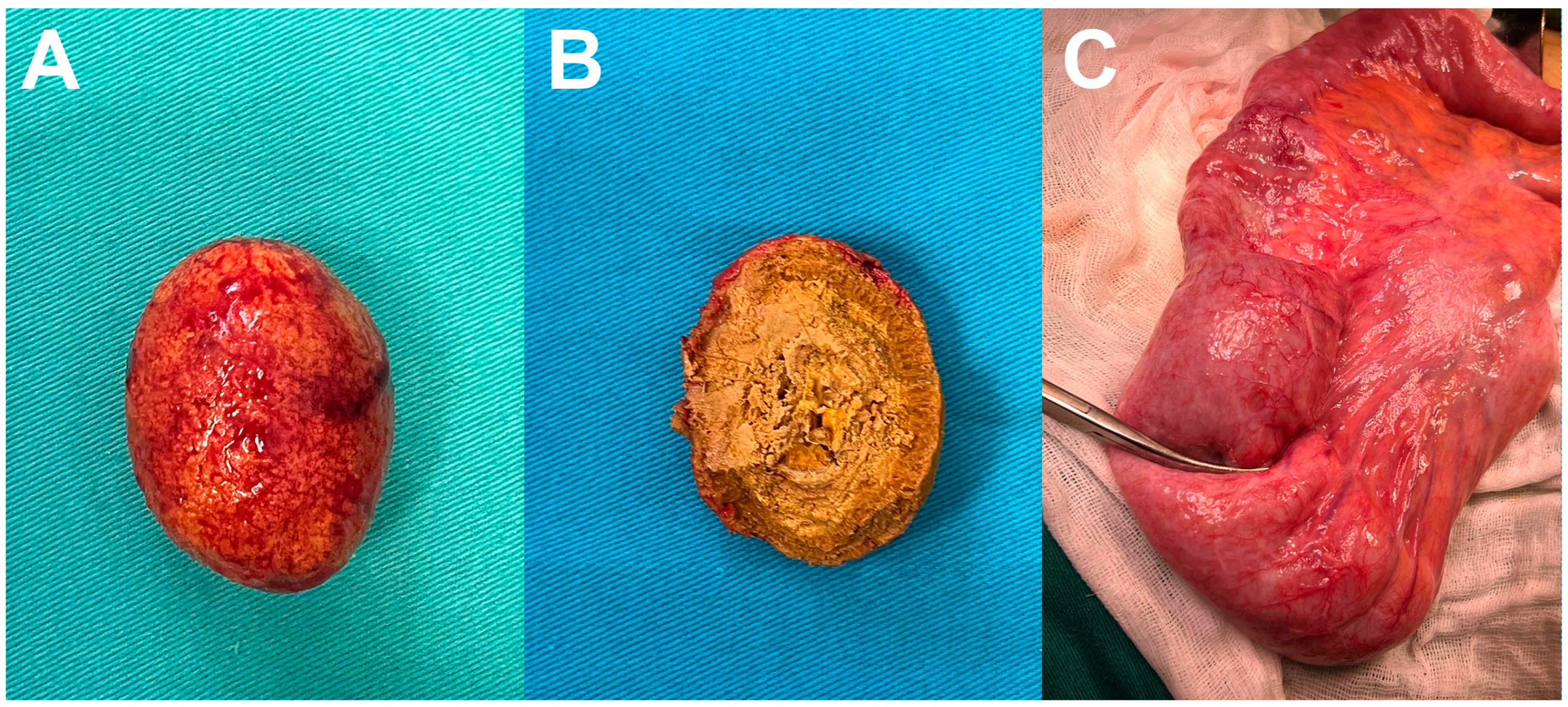 Diagnostics 14 00360 g004