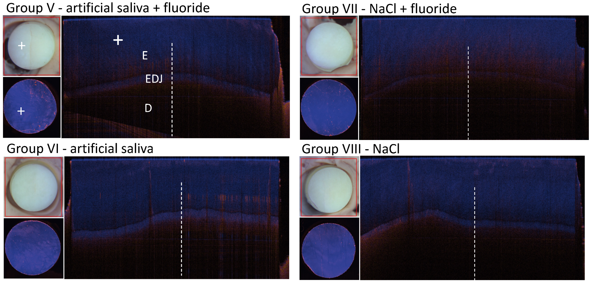 Diagnostics 14 00367 g0a6