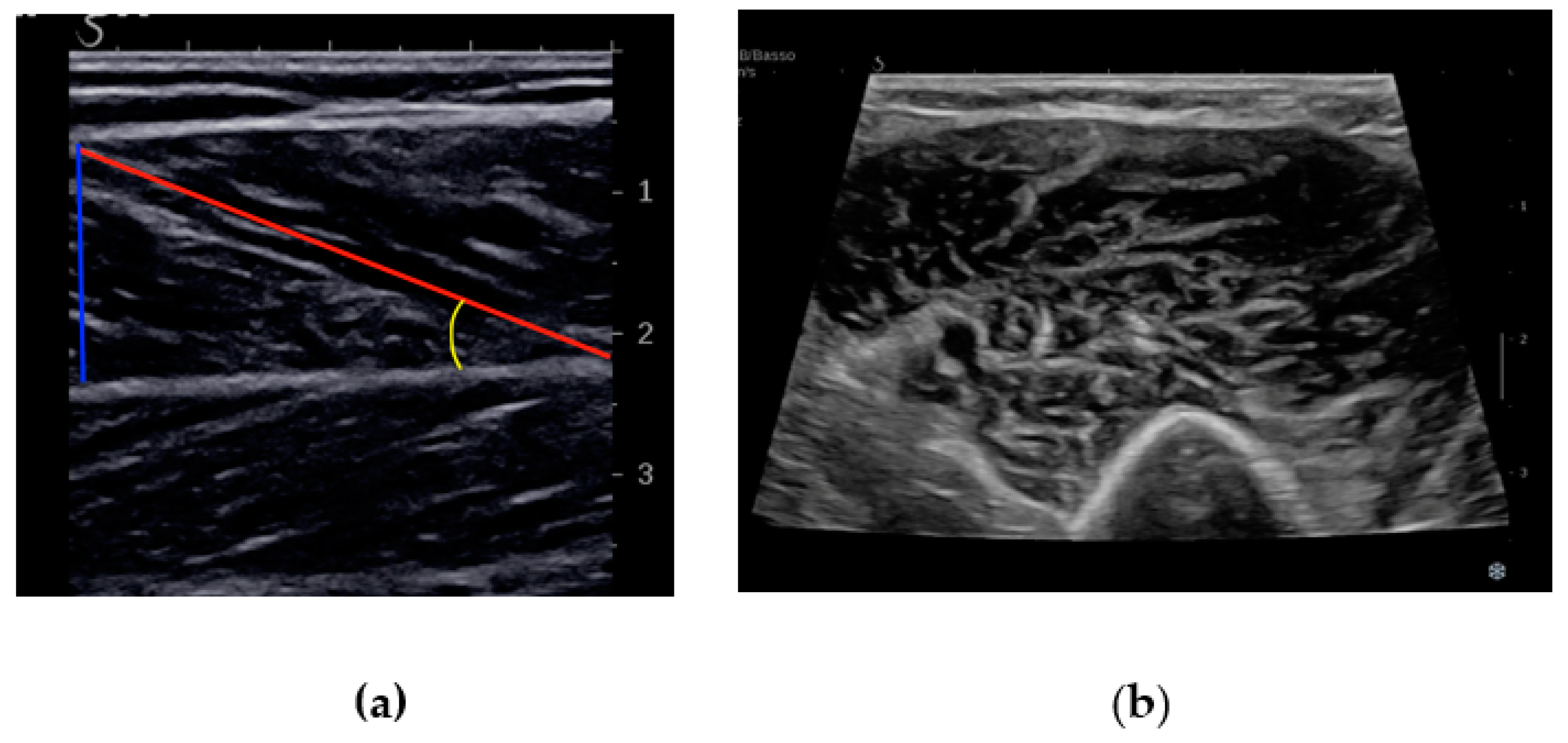 Diagnostics 14 00371 g002