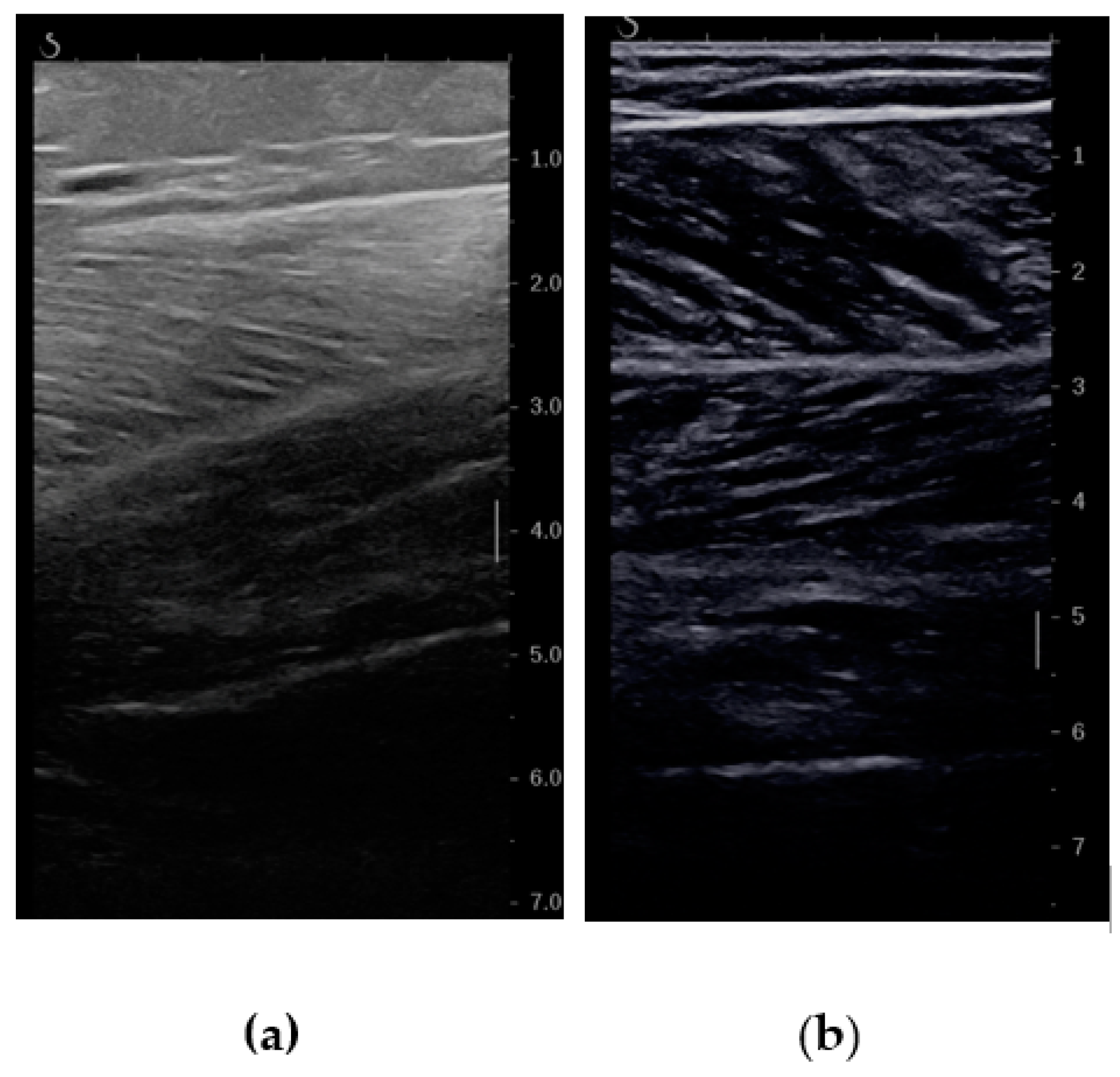 Diagnostics 14 00371 g003