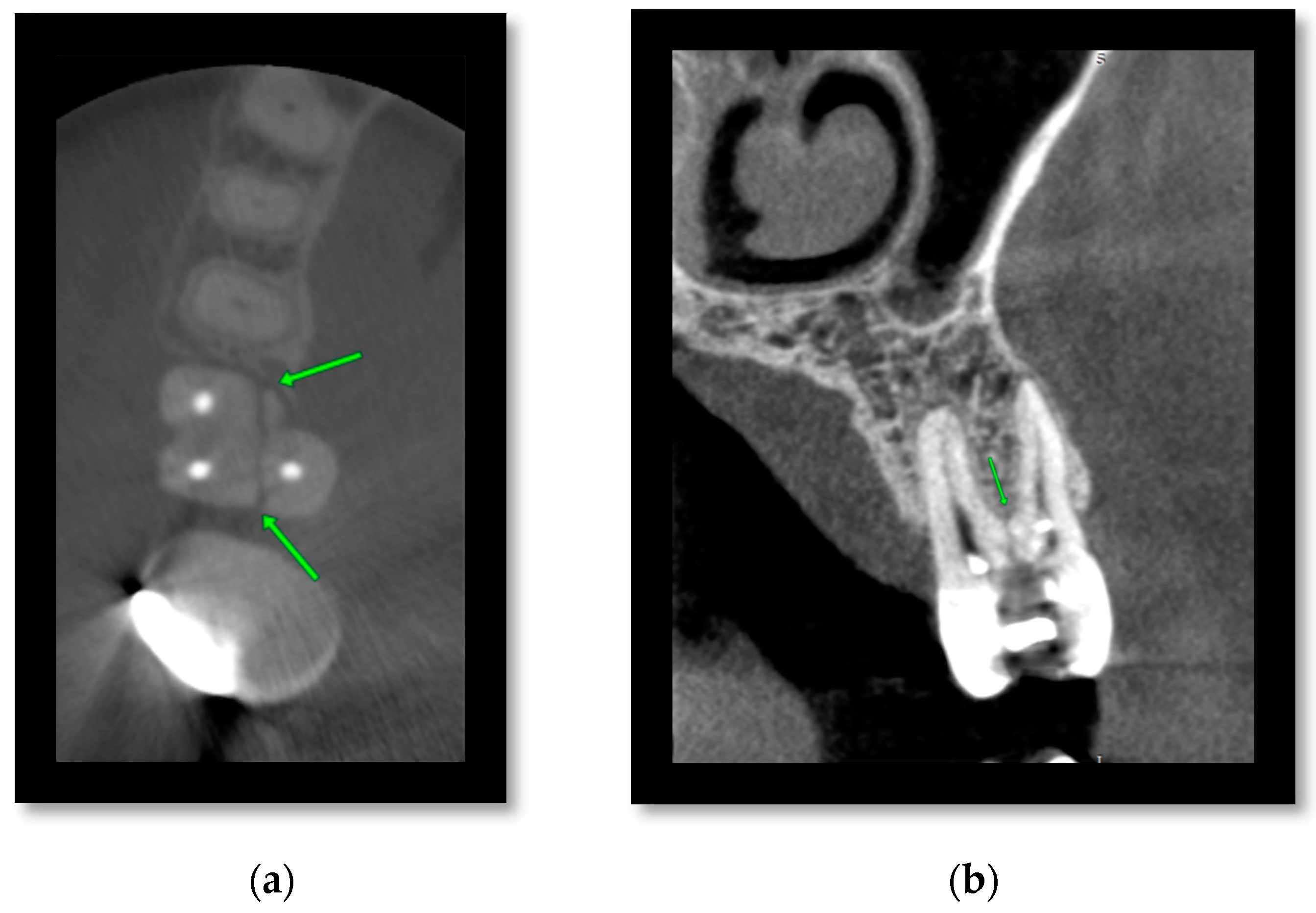 Diagnostics 14 00373 g002 Diagnostics 14 00373 g002