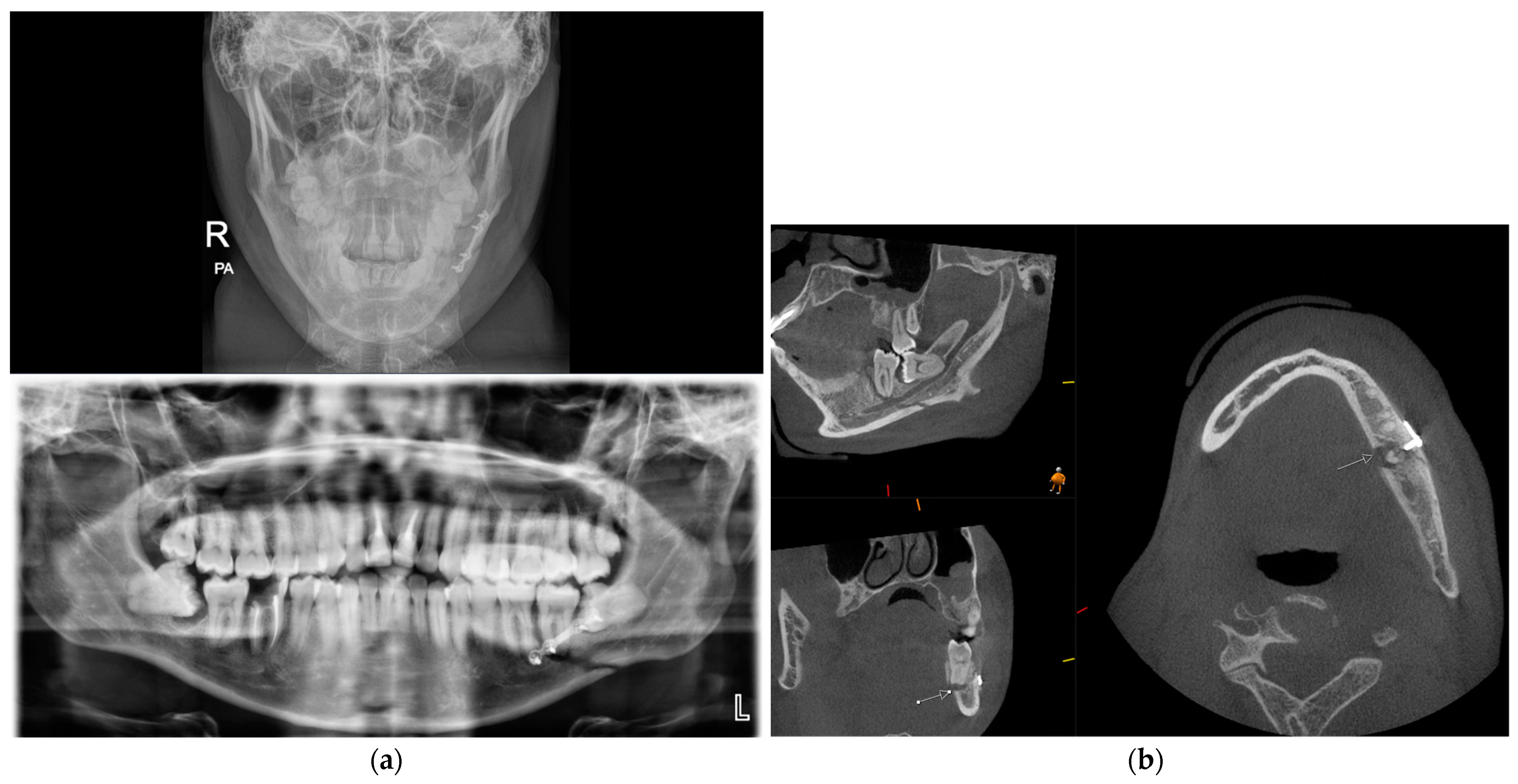 Diagnostics 14 00373 g003 Diagnostics 14 00373 g003