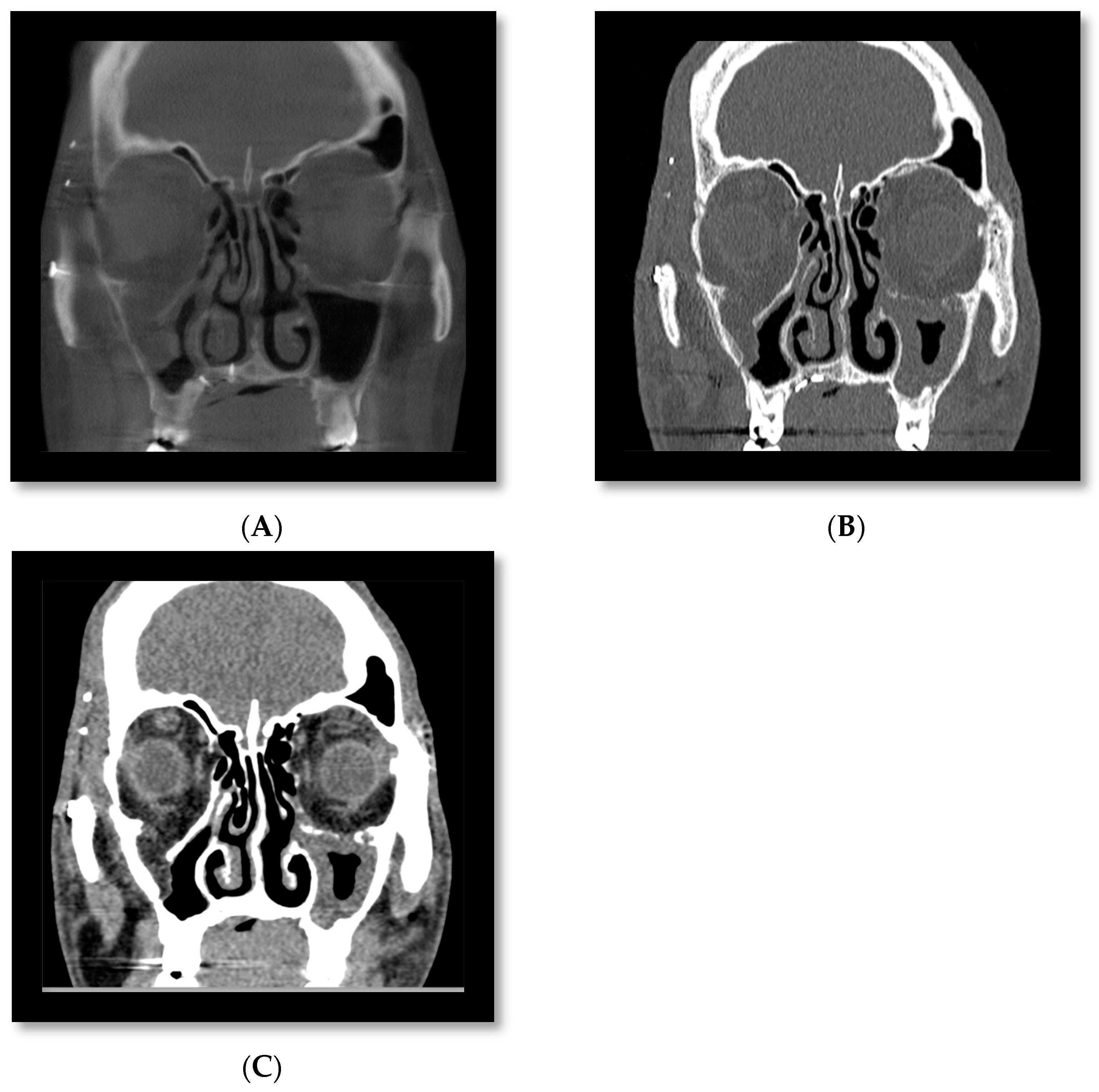 Diagnostics 14 00373 g005a Diagnostics 14 00373 g005a
