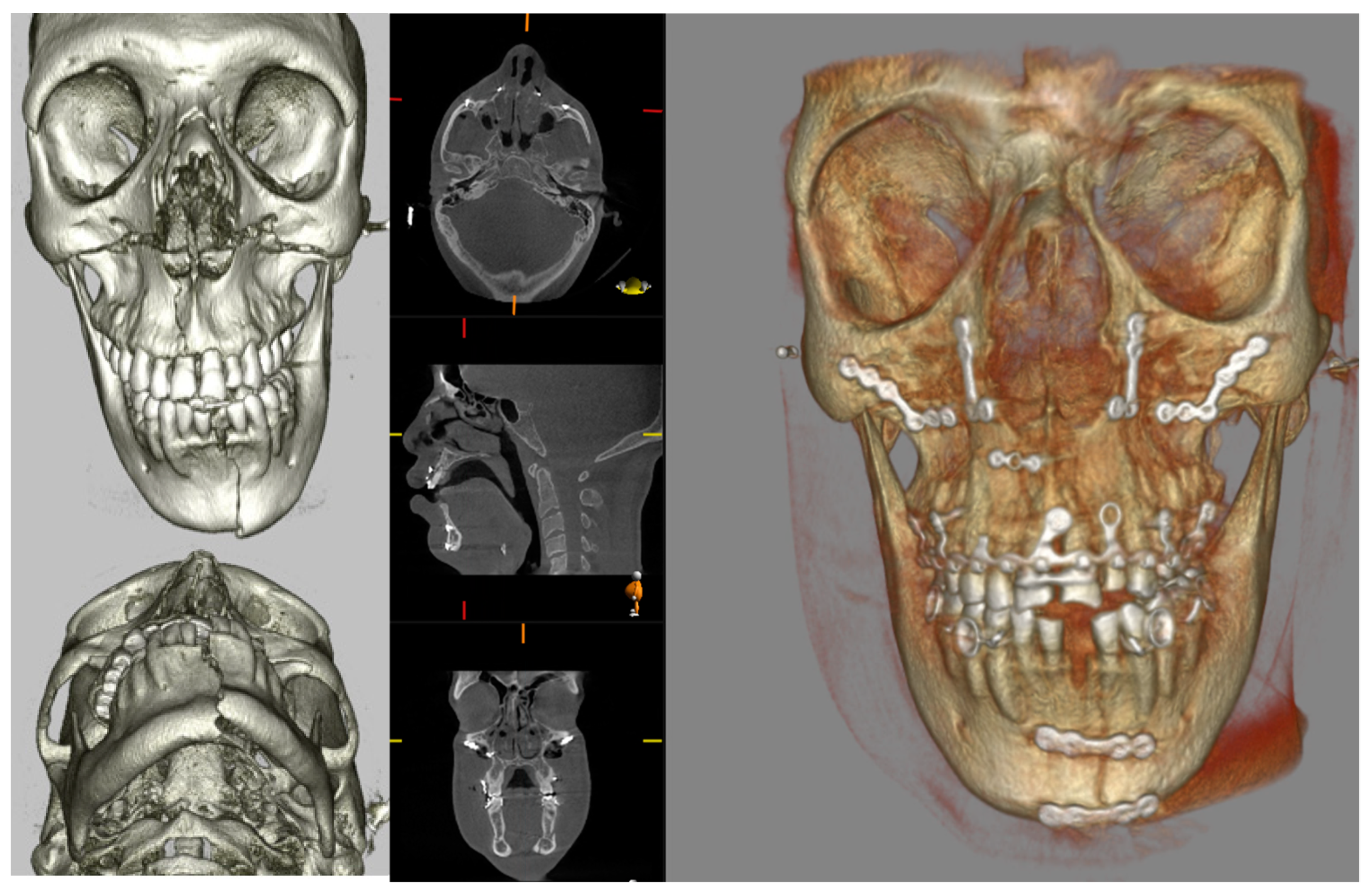 Diagnostics 14 00373 g007 Diagnostics 14 00373 g007