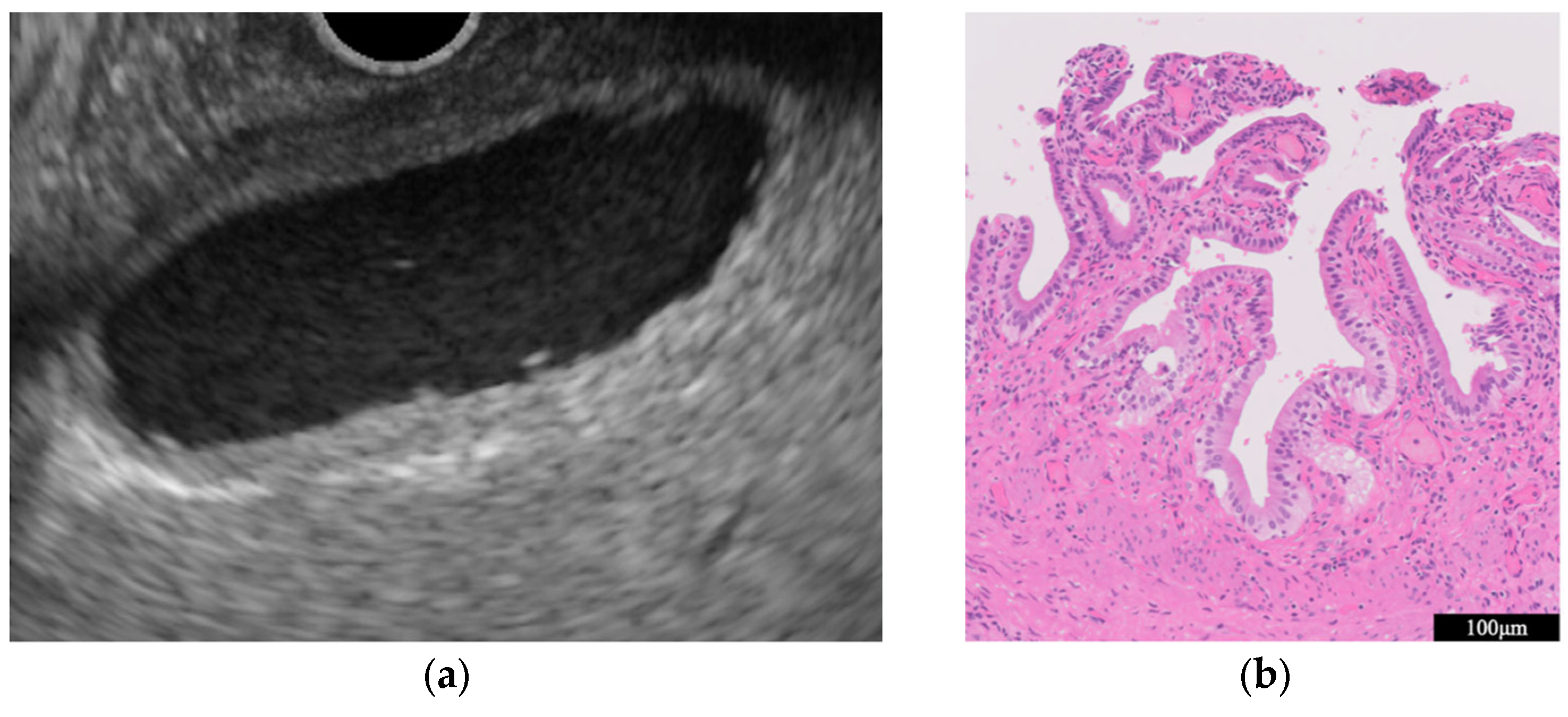 Diagnostics 14 00374 g002