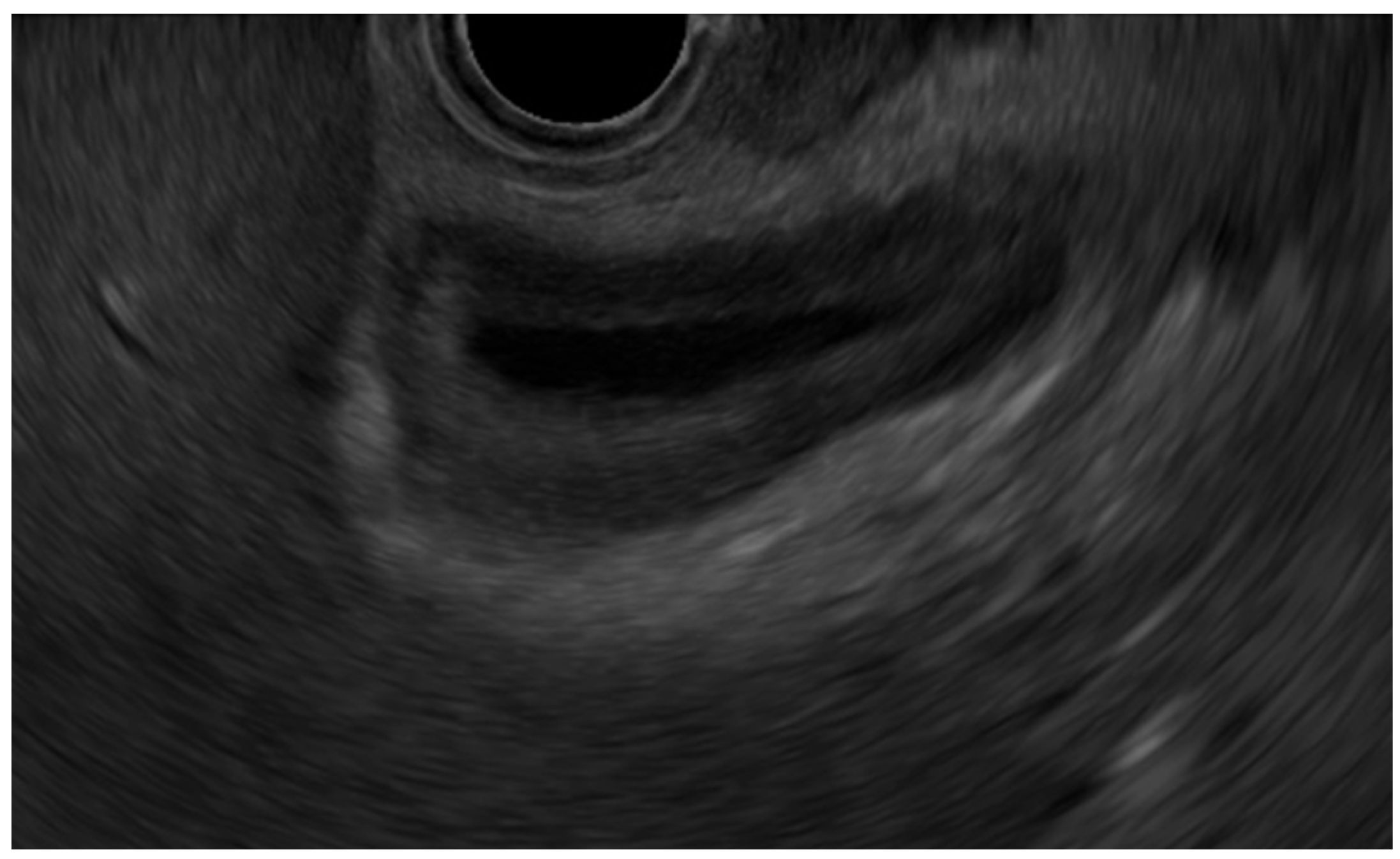 Diagnostics 14 00374 g003