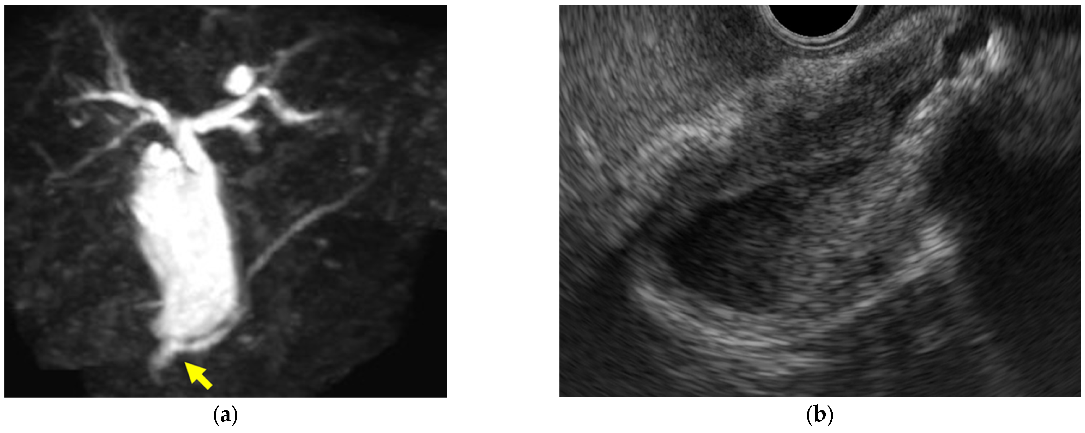 Diagnostics 14 00374 g004