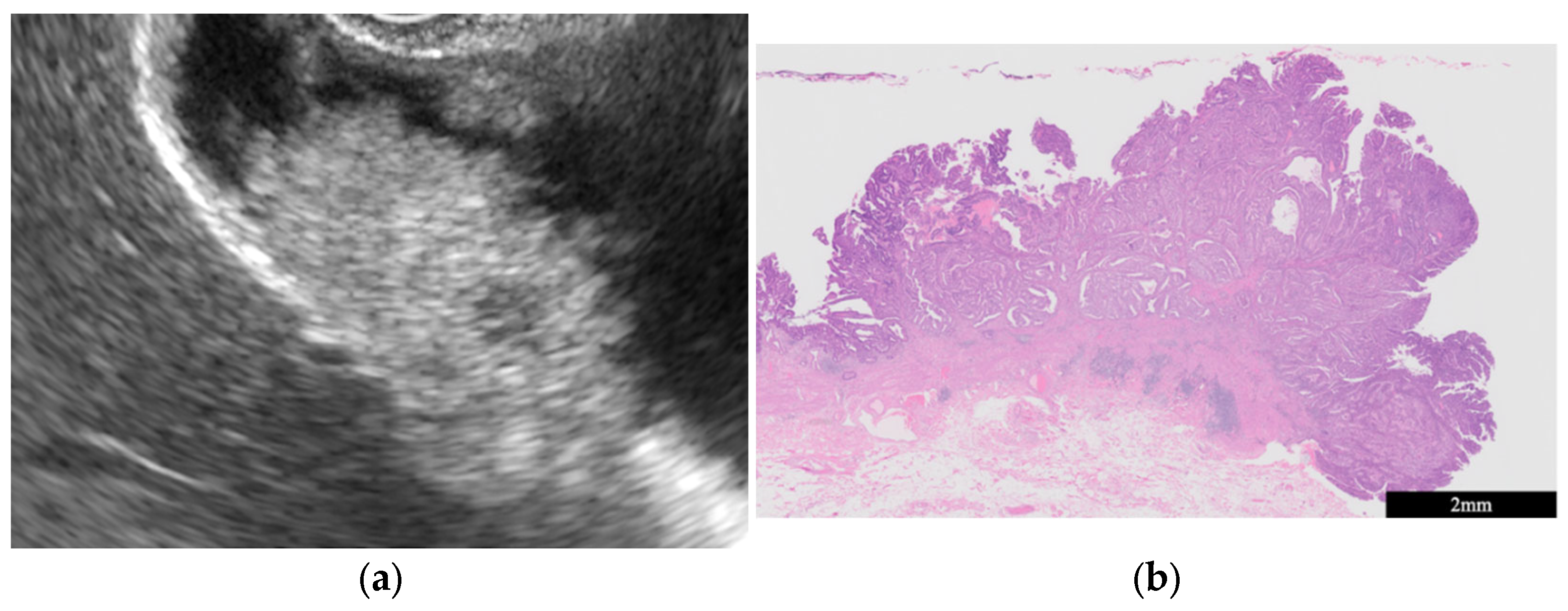 Diagnostics 14 00374 g006