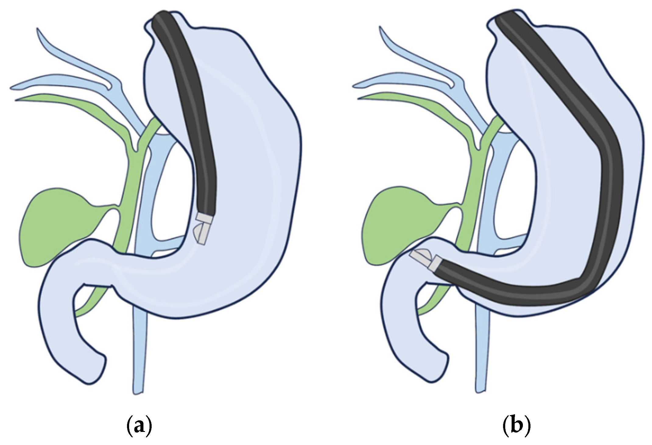Diagnostics 14 00374 g008