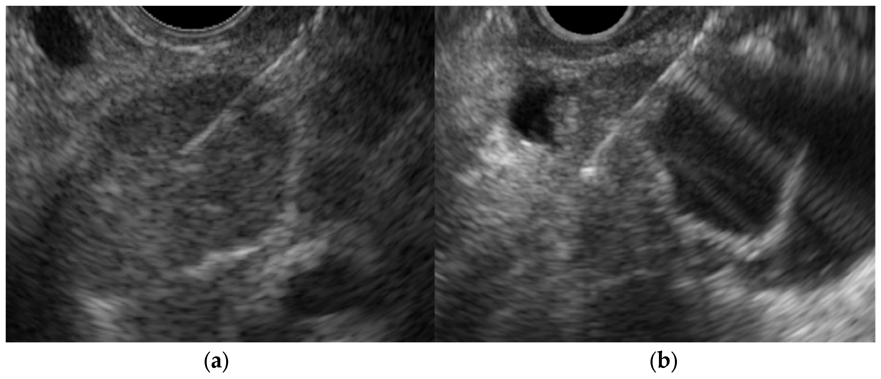 Diagnostics 14 00374 g009