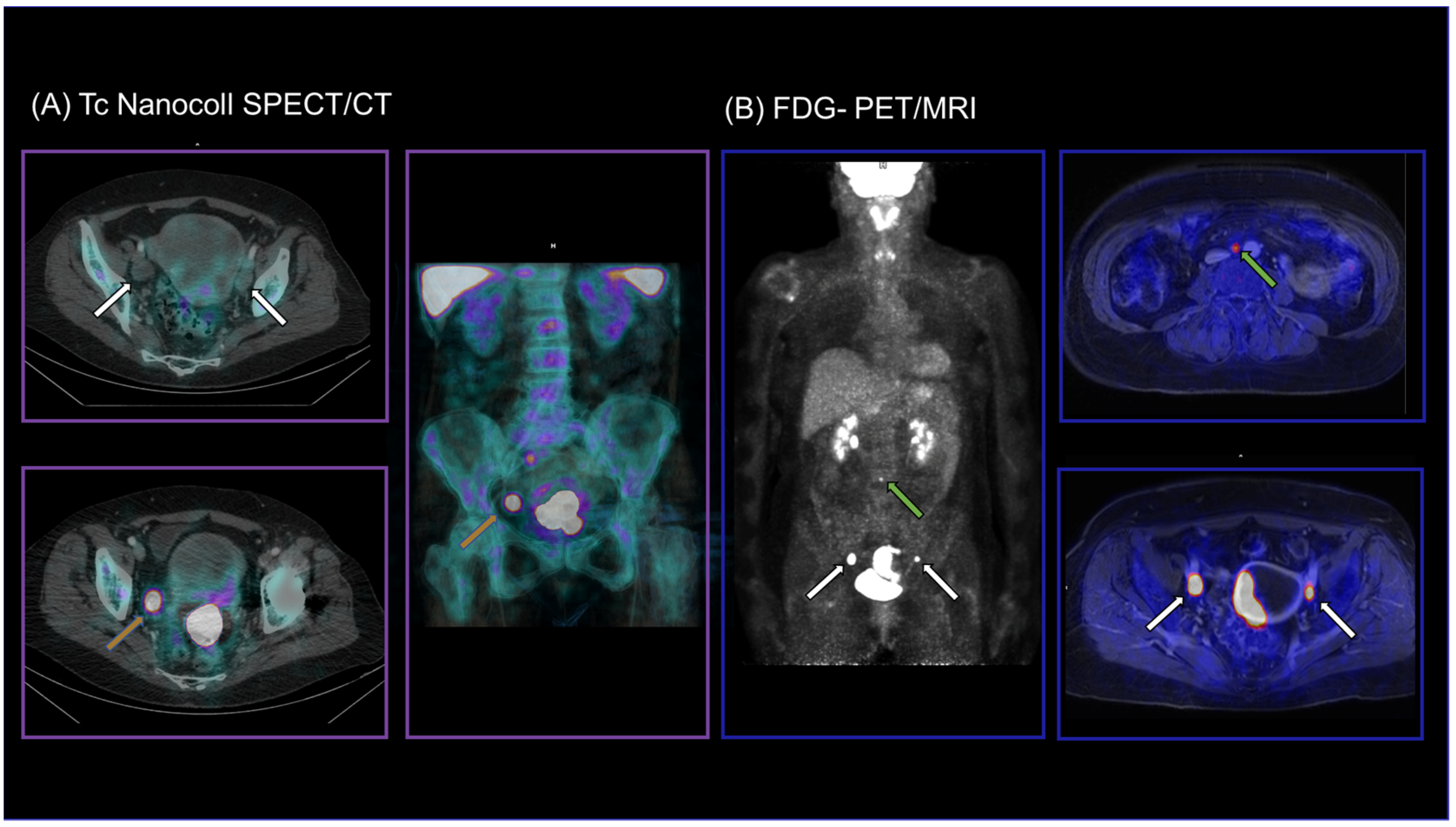 Diagnostics 14 00376 g002