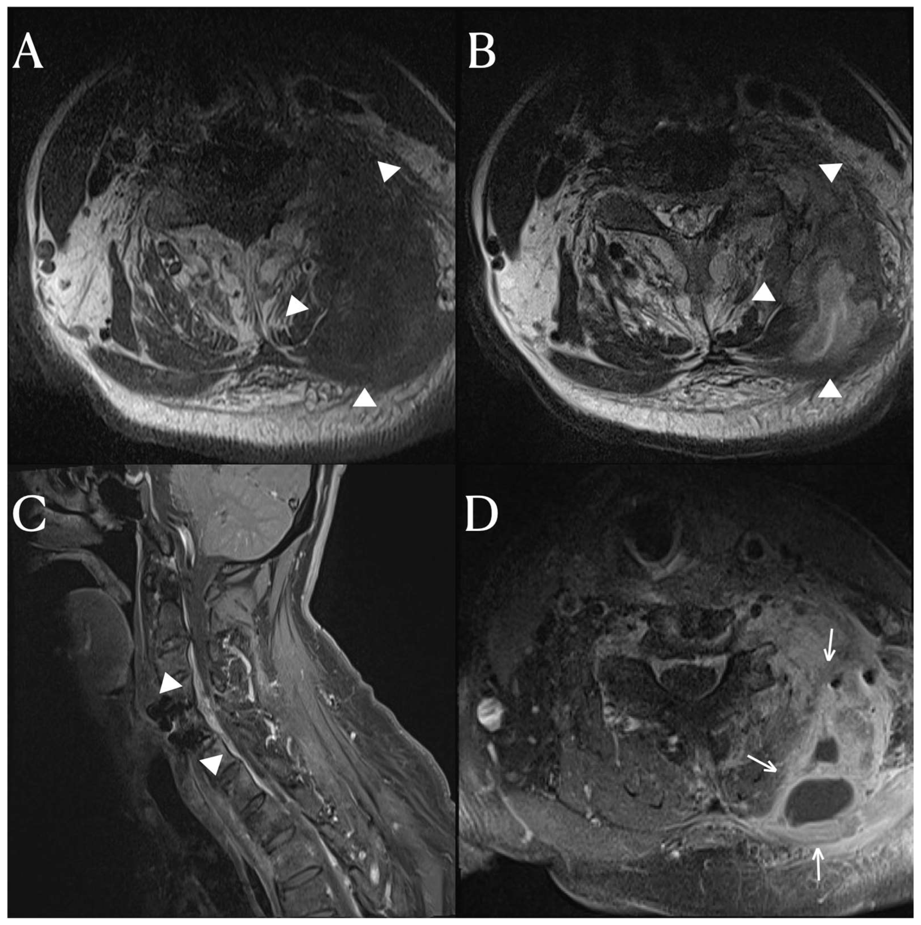 Diagnostics 14 00391 g001