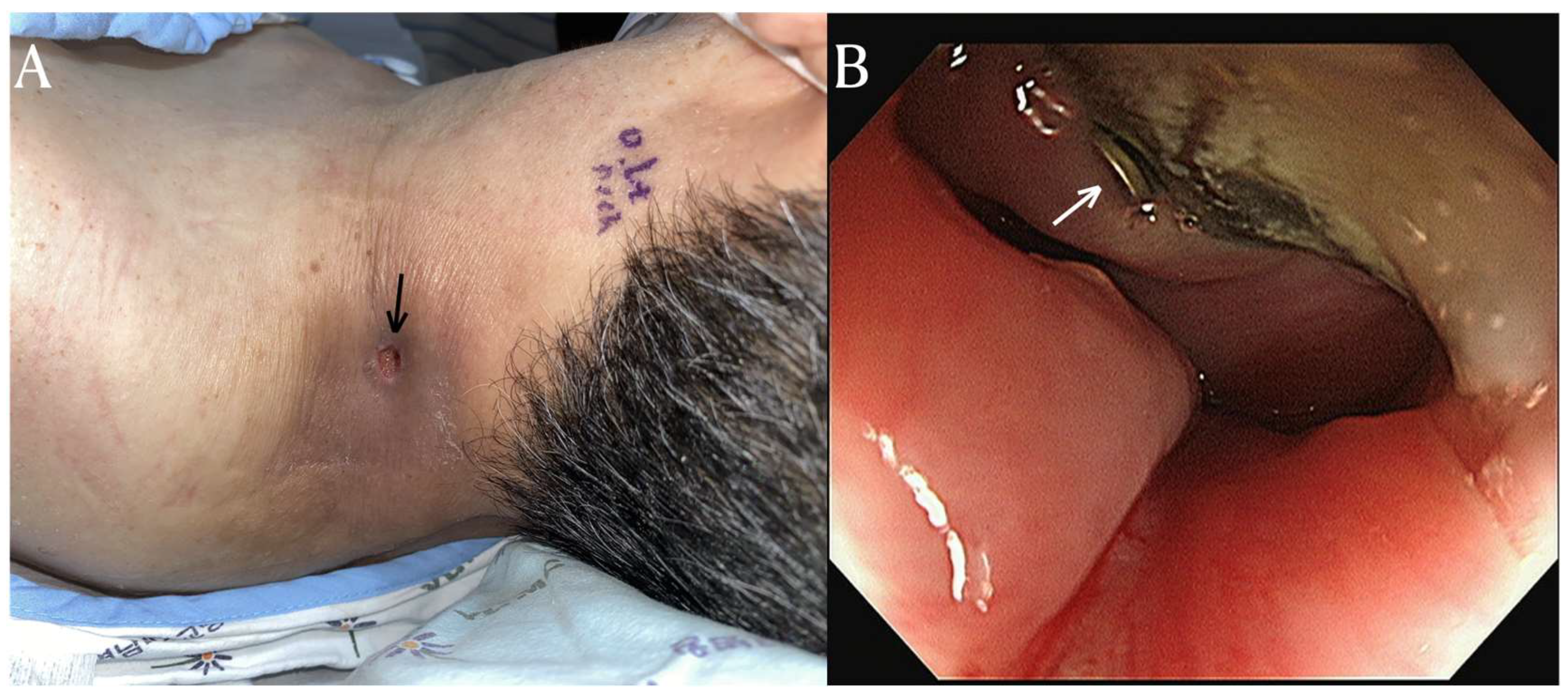 Diagnostics 14 00391 g002