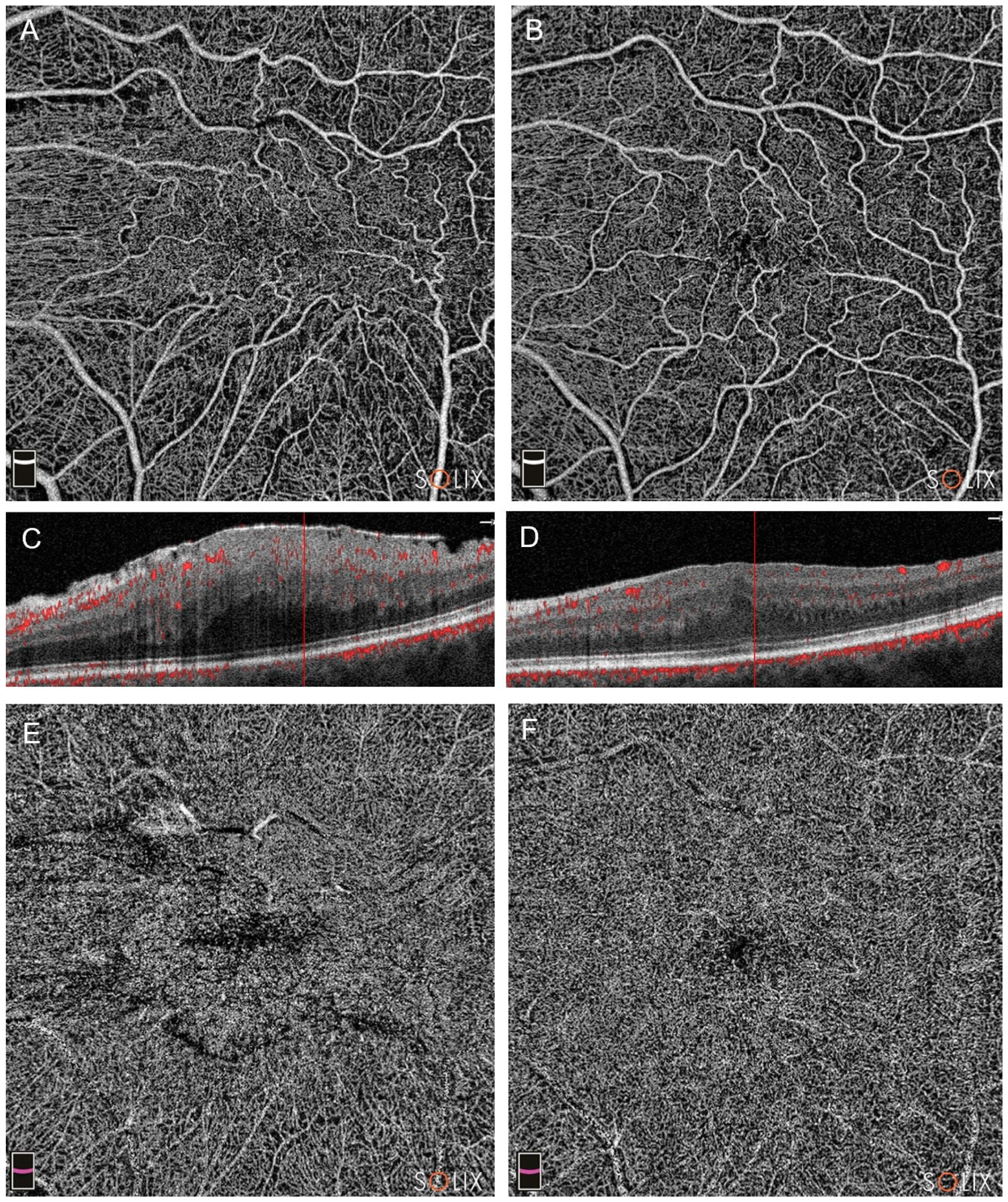 Diagnostics 14 00411 g003