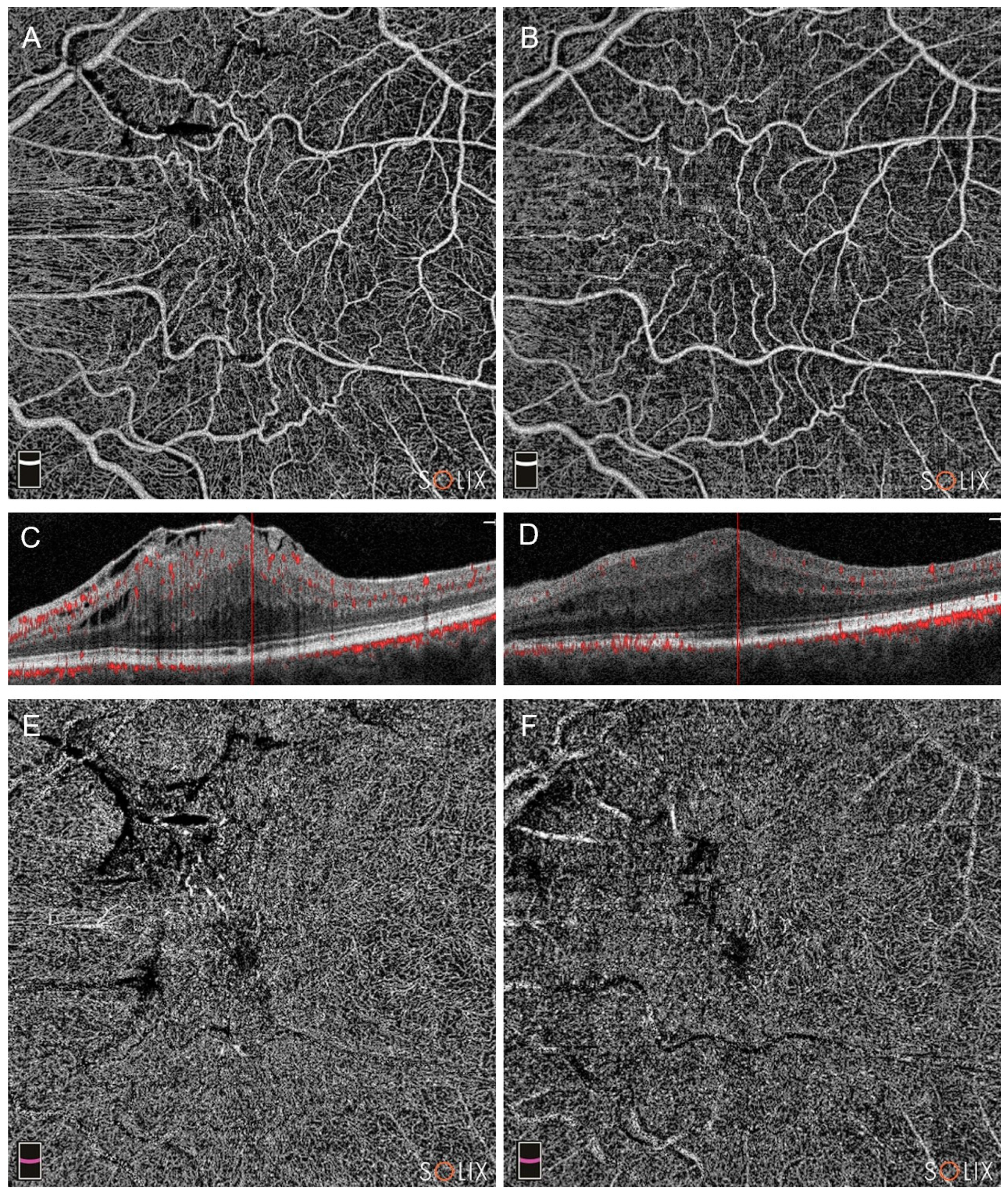 Diagnostics 14 00411 g004