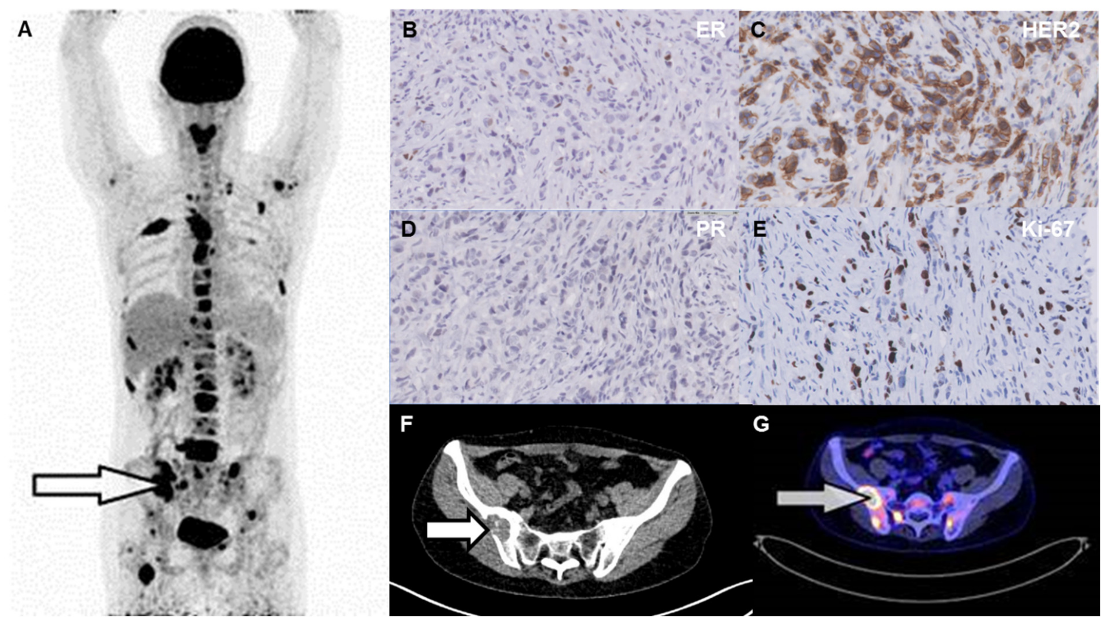 Diagnostics 14 00416 g004