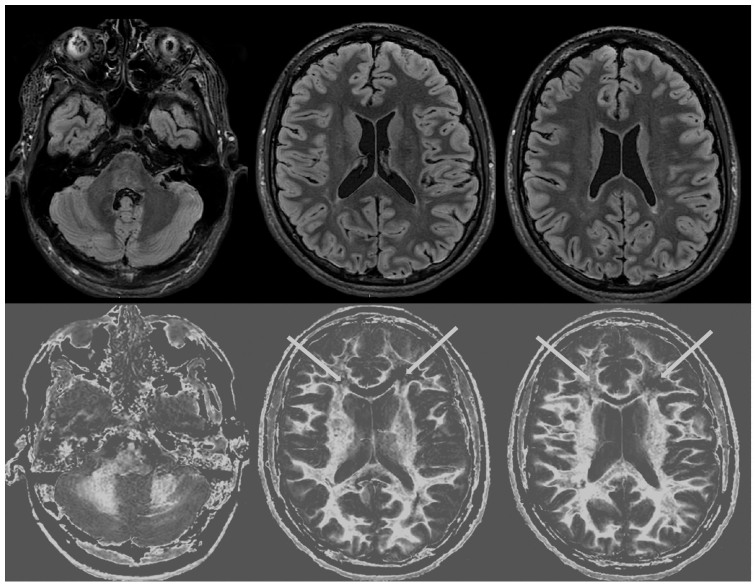 Diagnostics 14 00418 g004