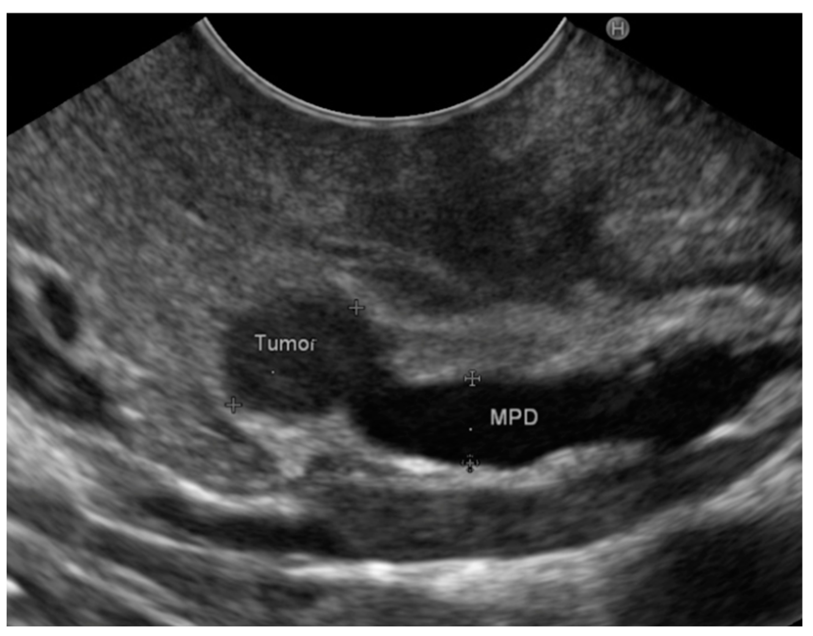 Diagnostics 14 00427 g002 Diagnostics 14 00427 g002