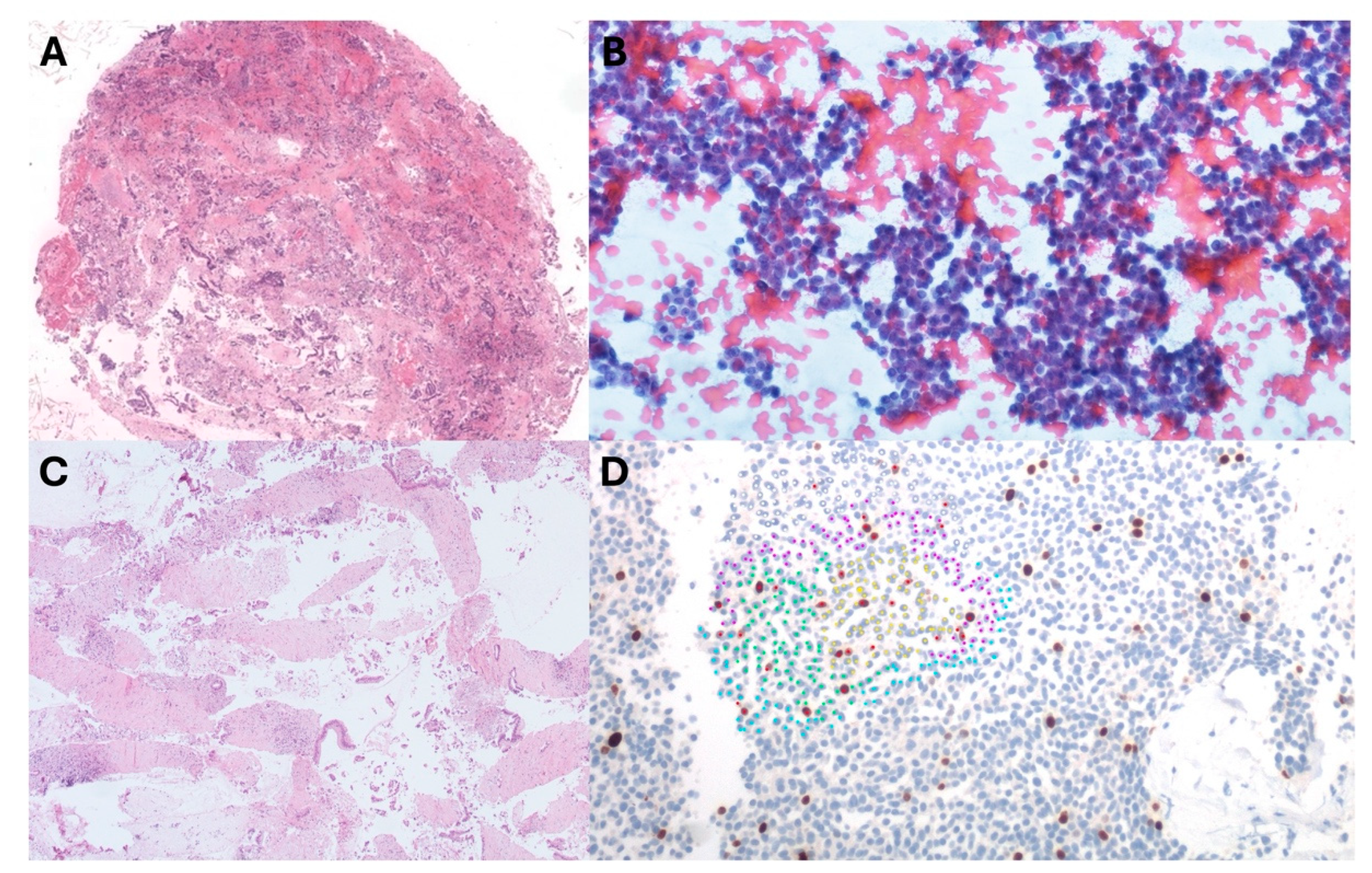 Diagnostics 14 00427 g003 Diagnostics 14 00427 g003