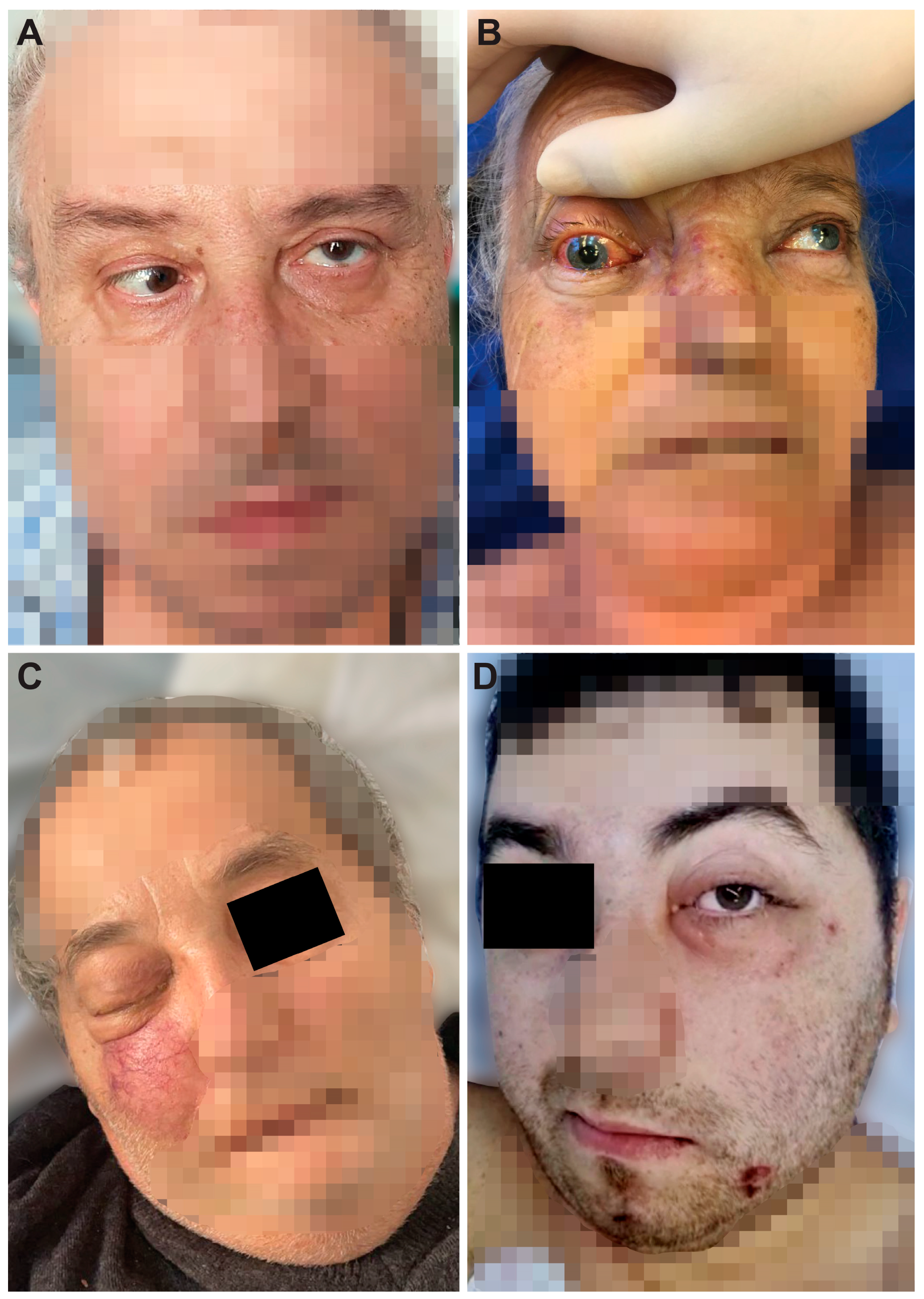 Diagnostics 14 00429 g001