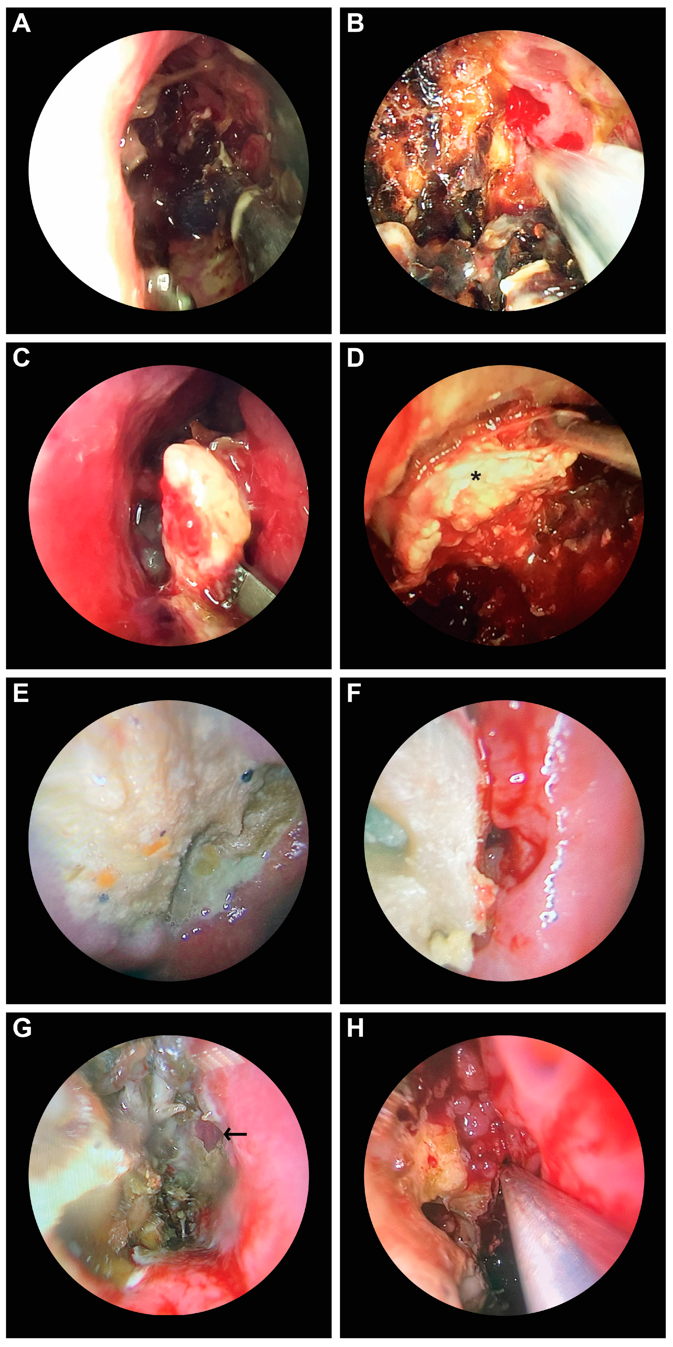Diagnostics 14 00429 g003a