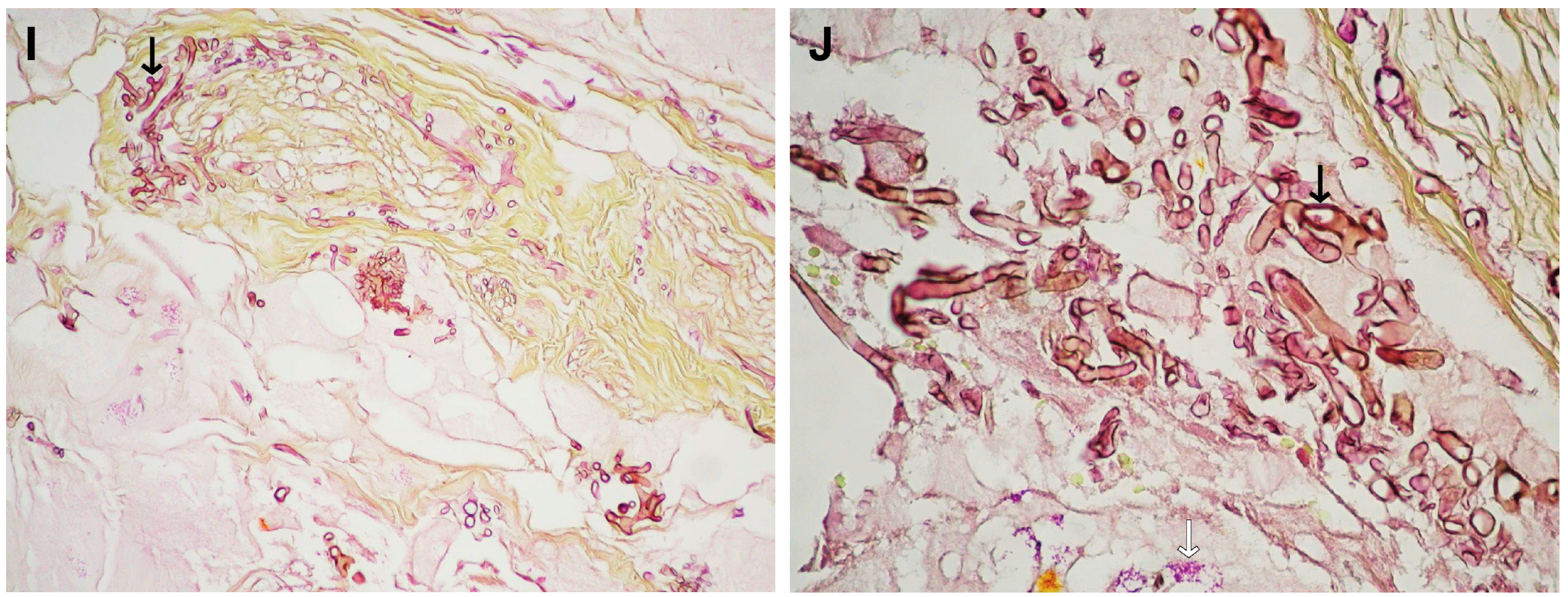 Diagnostics 14 00429 g004b