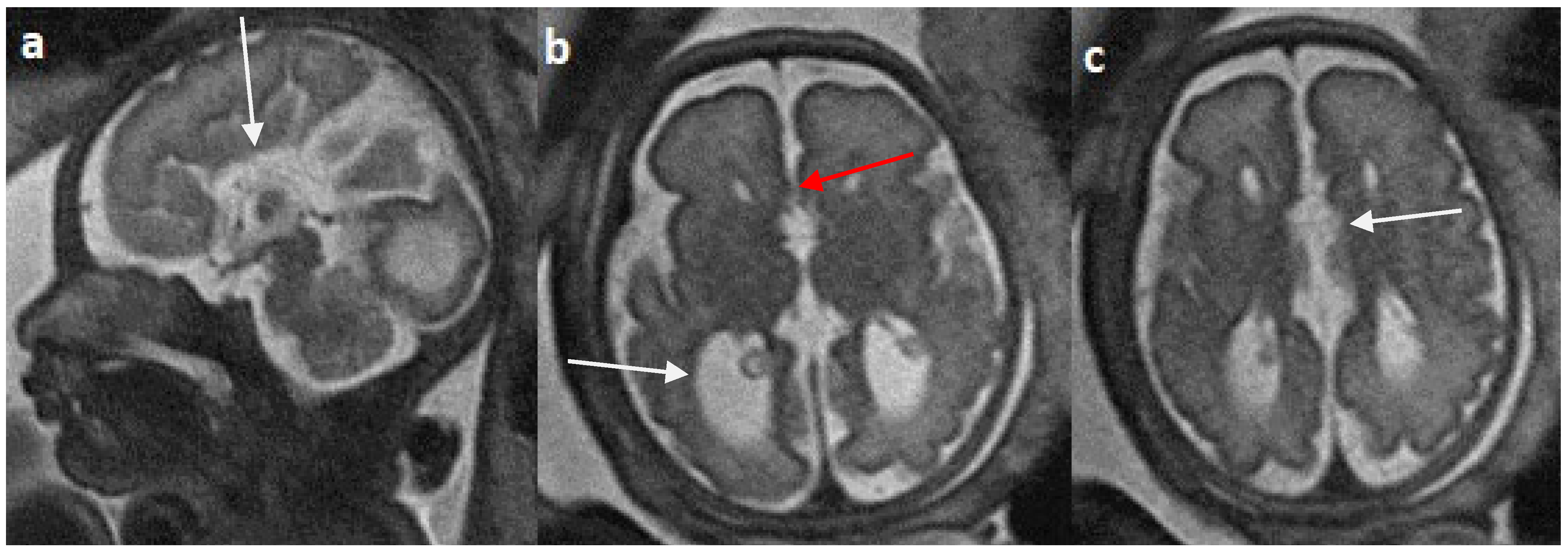 Diagnostics 14 00430 g005 Diagnostics 14 00430 g005