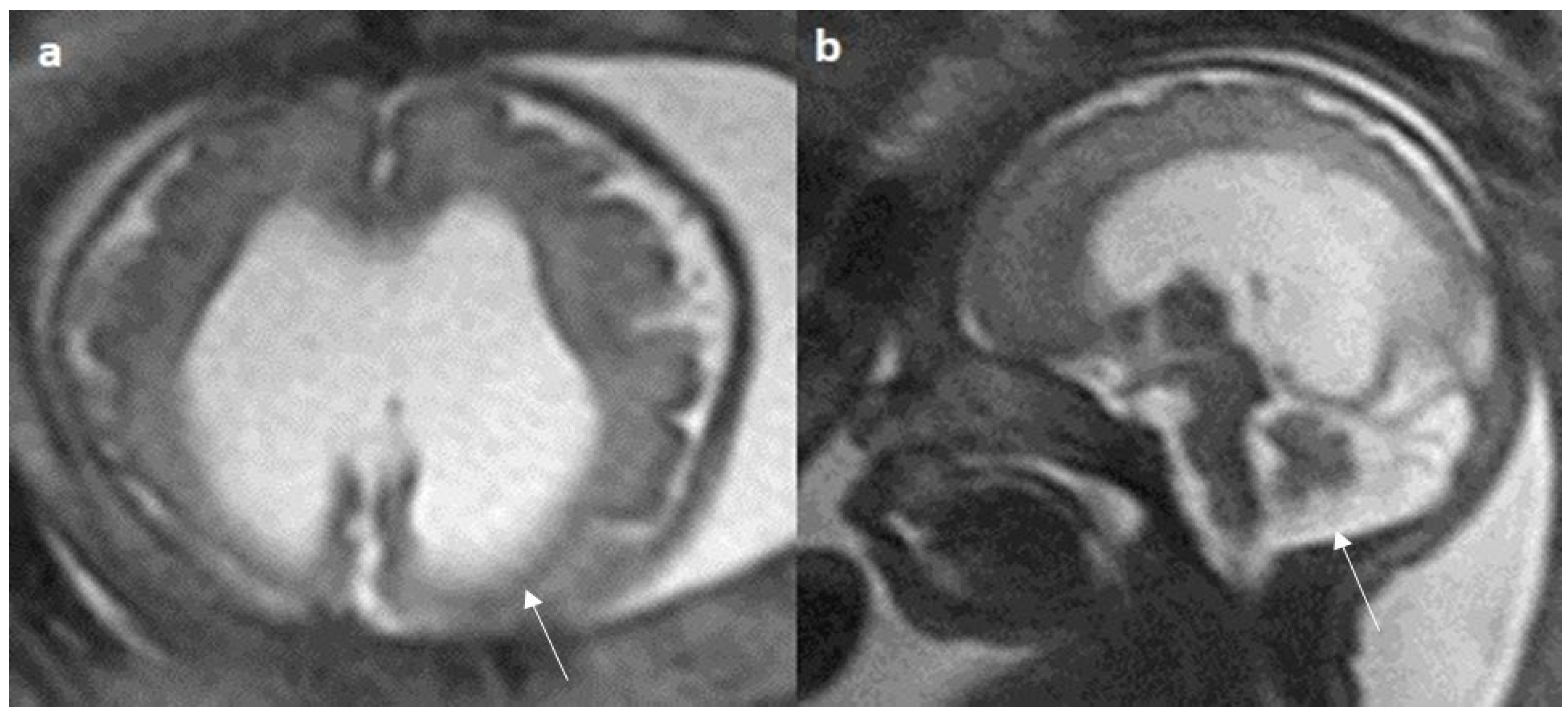 Diagnostics 14 00430 g006 Diagnostics 14 00430 g006
