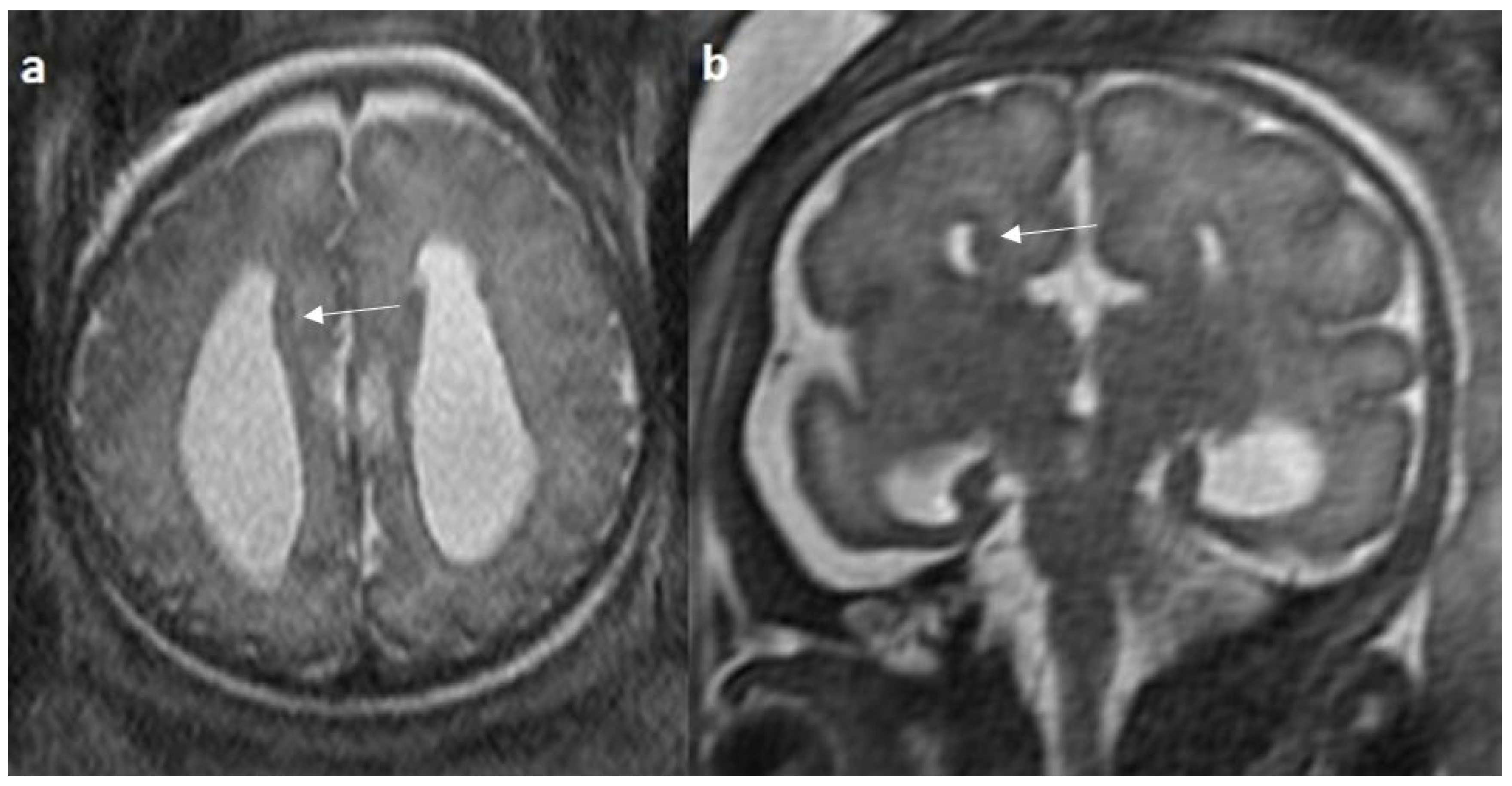 Diagnostics 14 00430 g007 Diagnostics 14 00430 g007