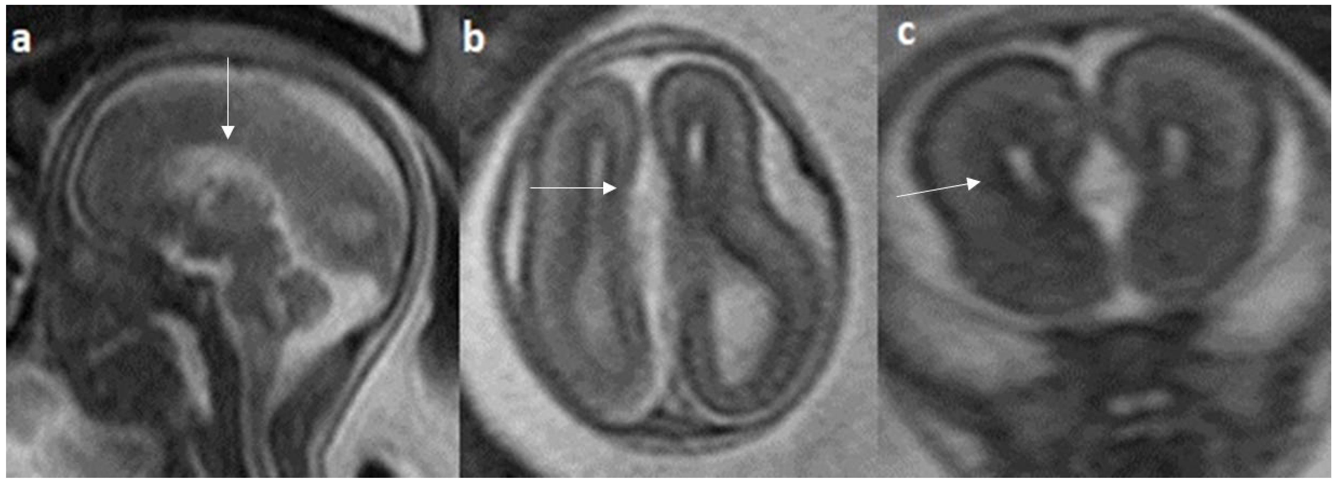 Diagnostics 14 00430 g009 Diagnostics 14 00430 g009