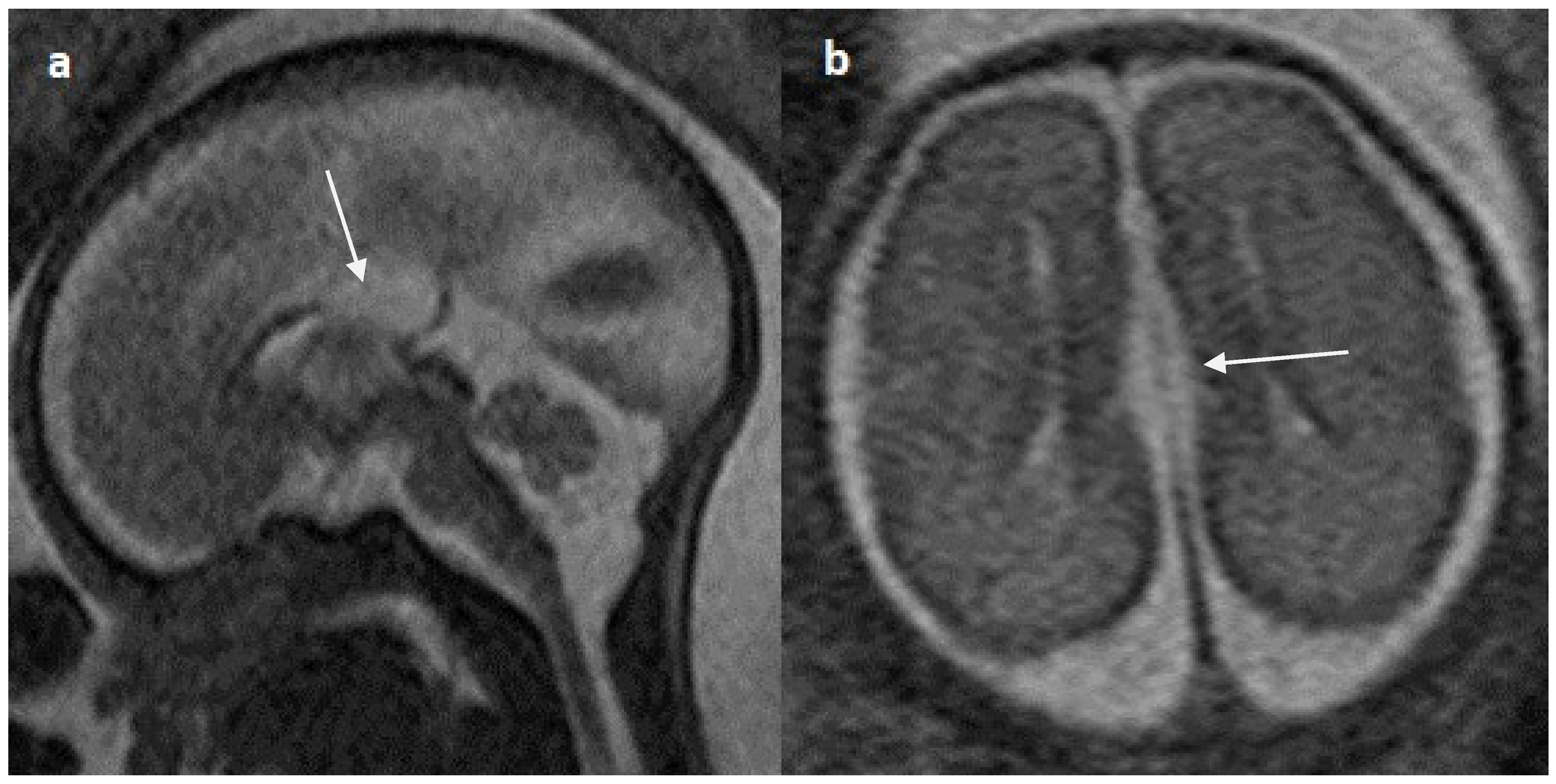 Diagnostics 14 00430 g010 Diagnostics 14 00430 g010