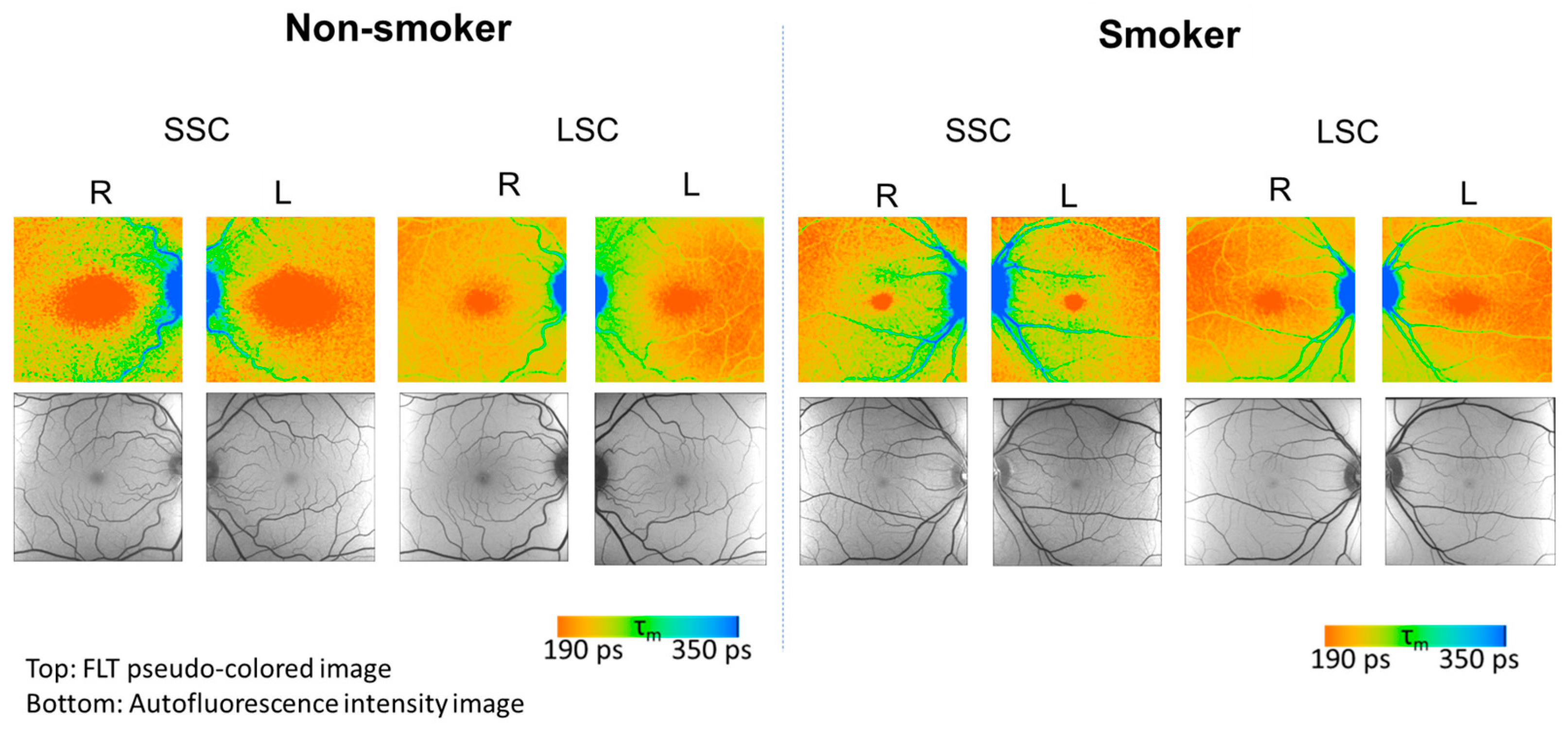 Diagnostics 14 00431 g001