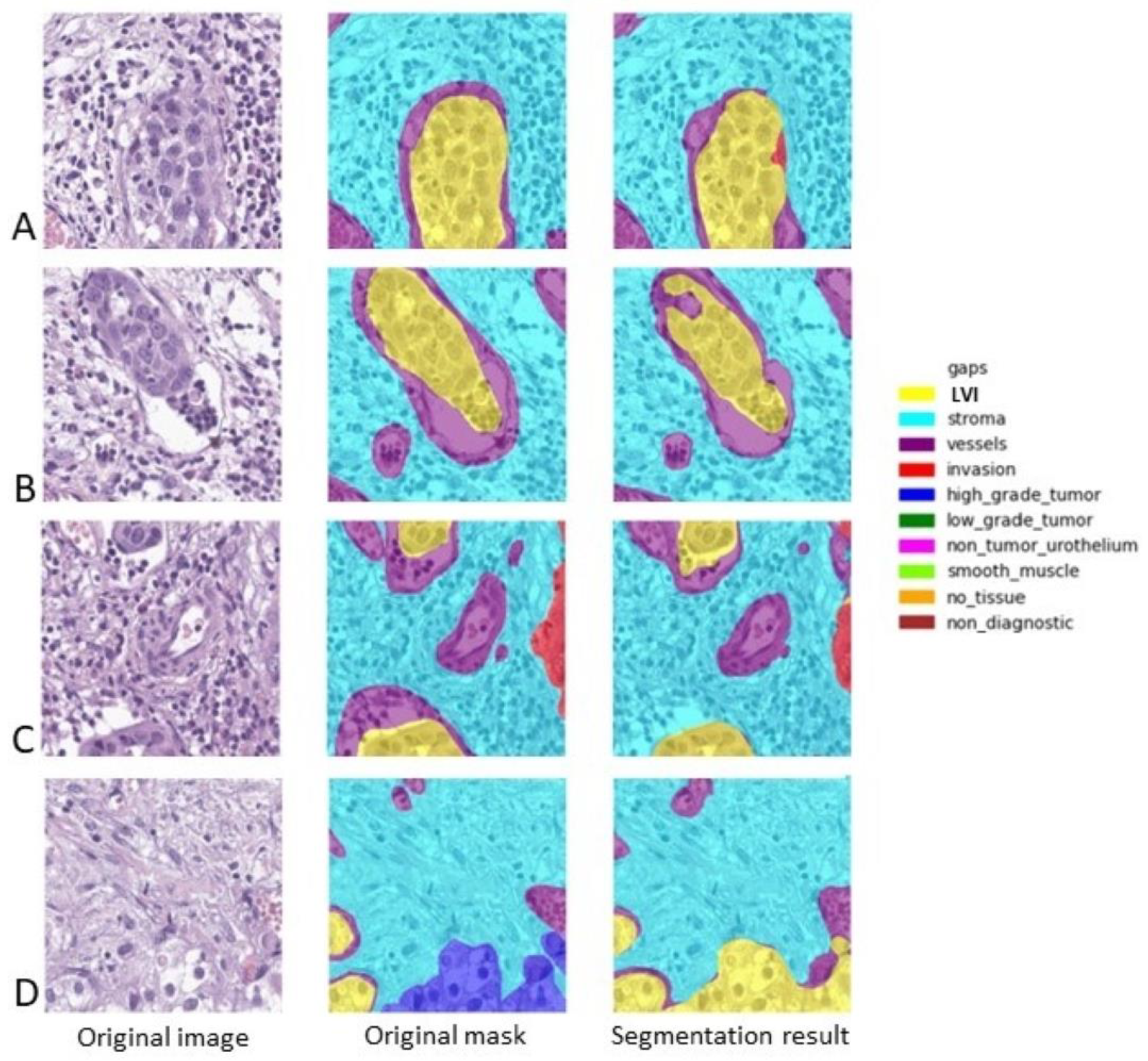 Diagnostics 14 00432 g003