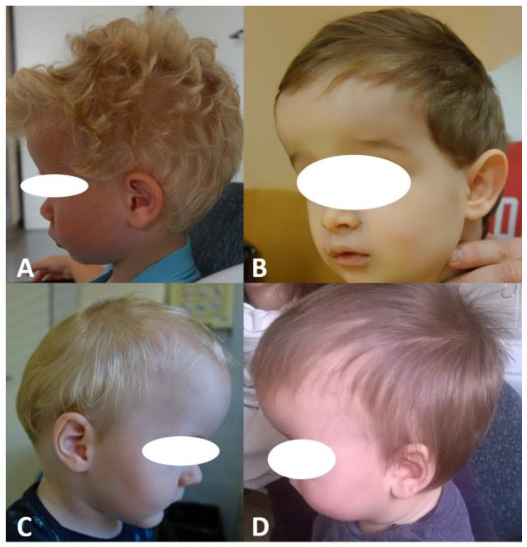 Diagnostics 14 00435 g006