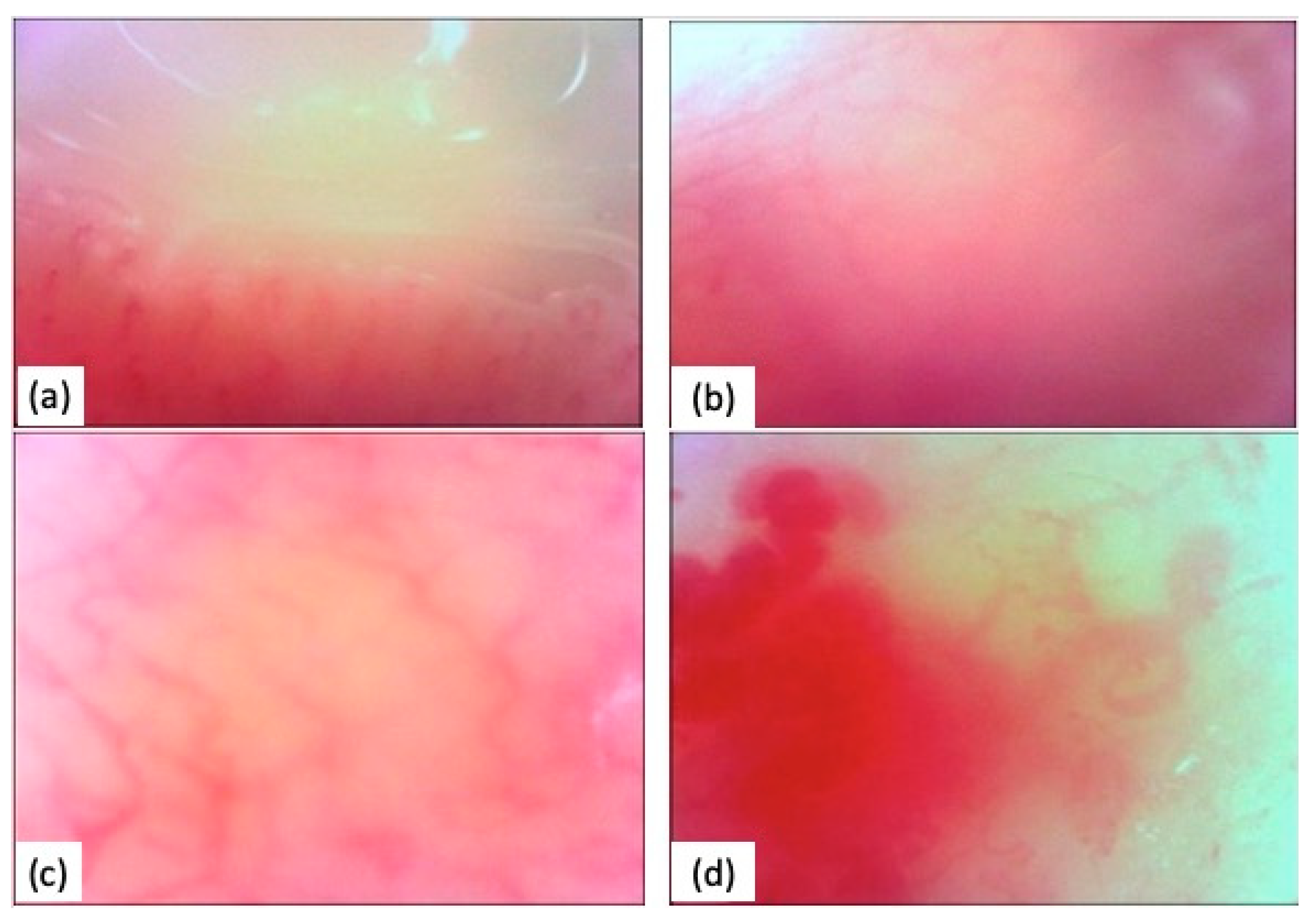 Diagnostics 14 00437 g002