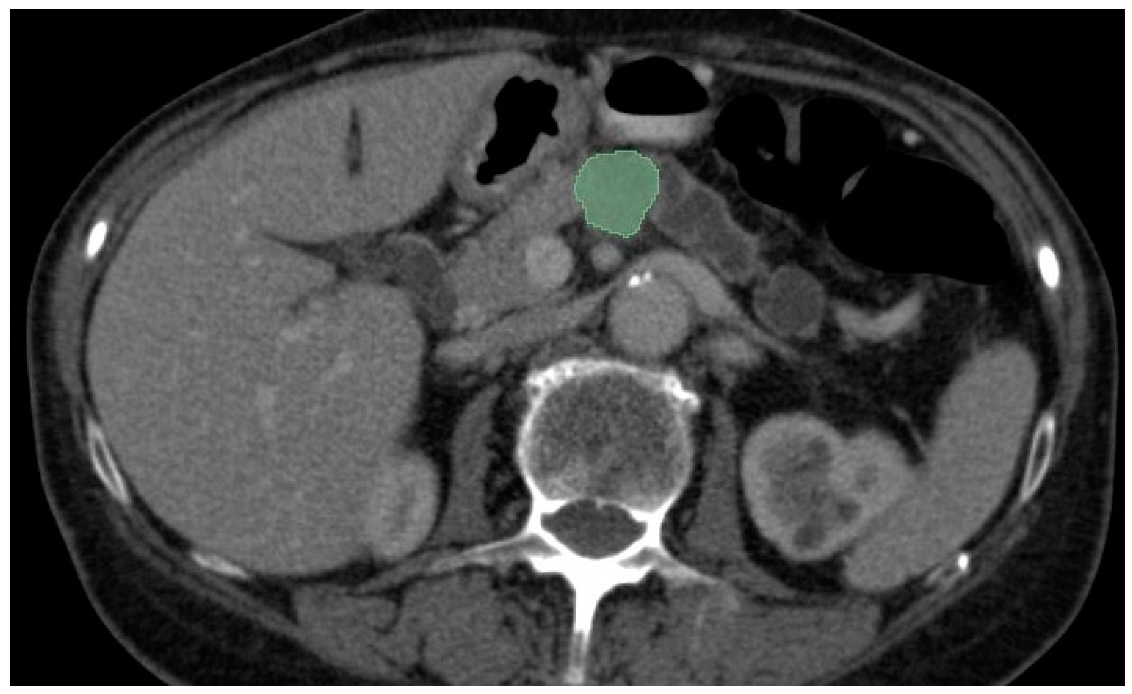 Diagnostics 14 00438 g004
