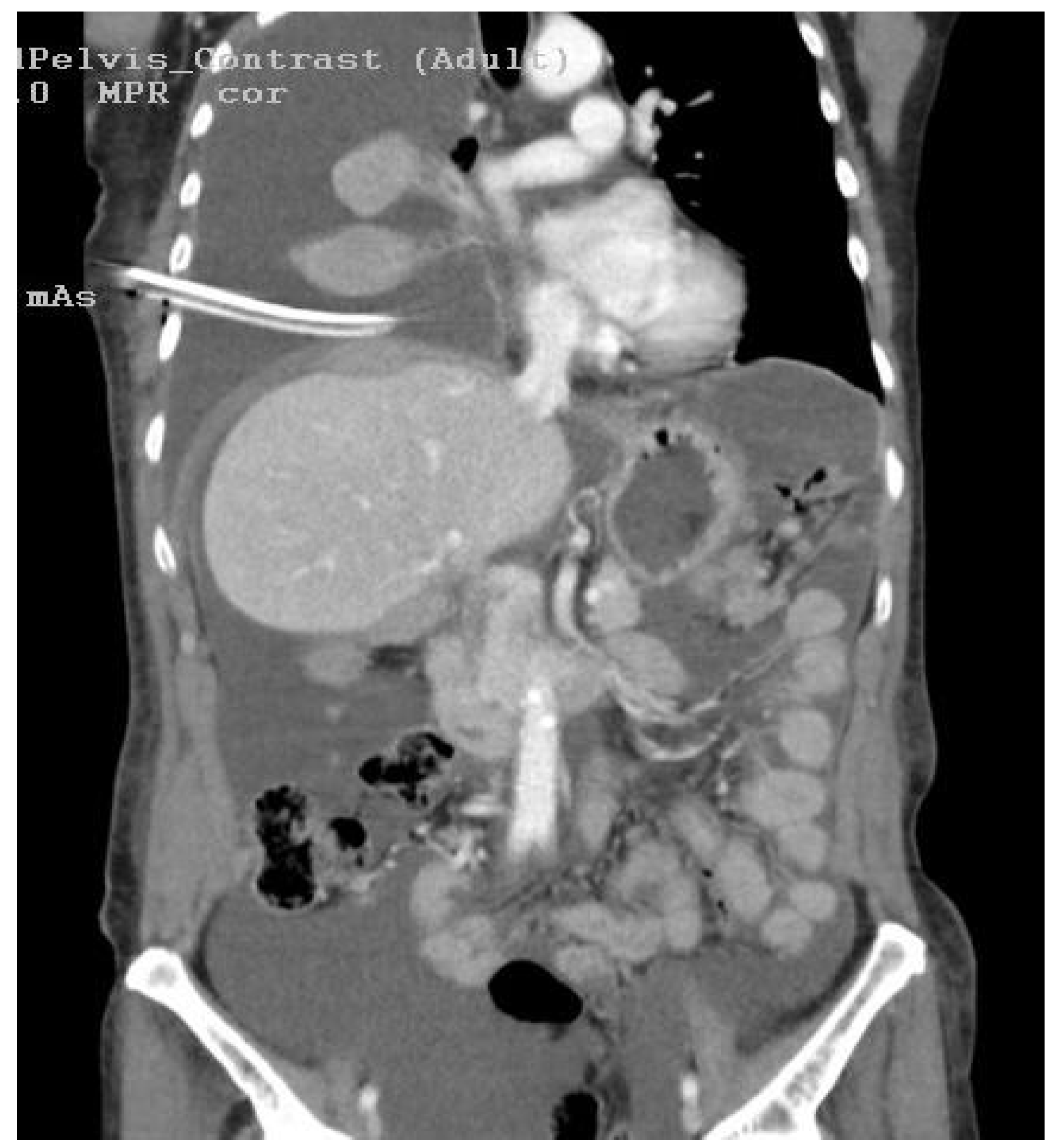 Diagnostics 14 00455 g001 Diagnostics 14 00455 g001