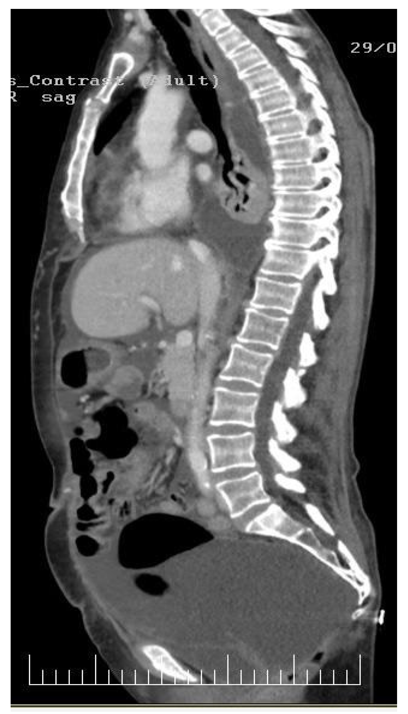 Diagnostics 14 00455 g002 Diagnostics 14 00455 g002
