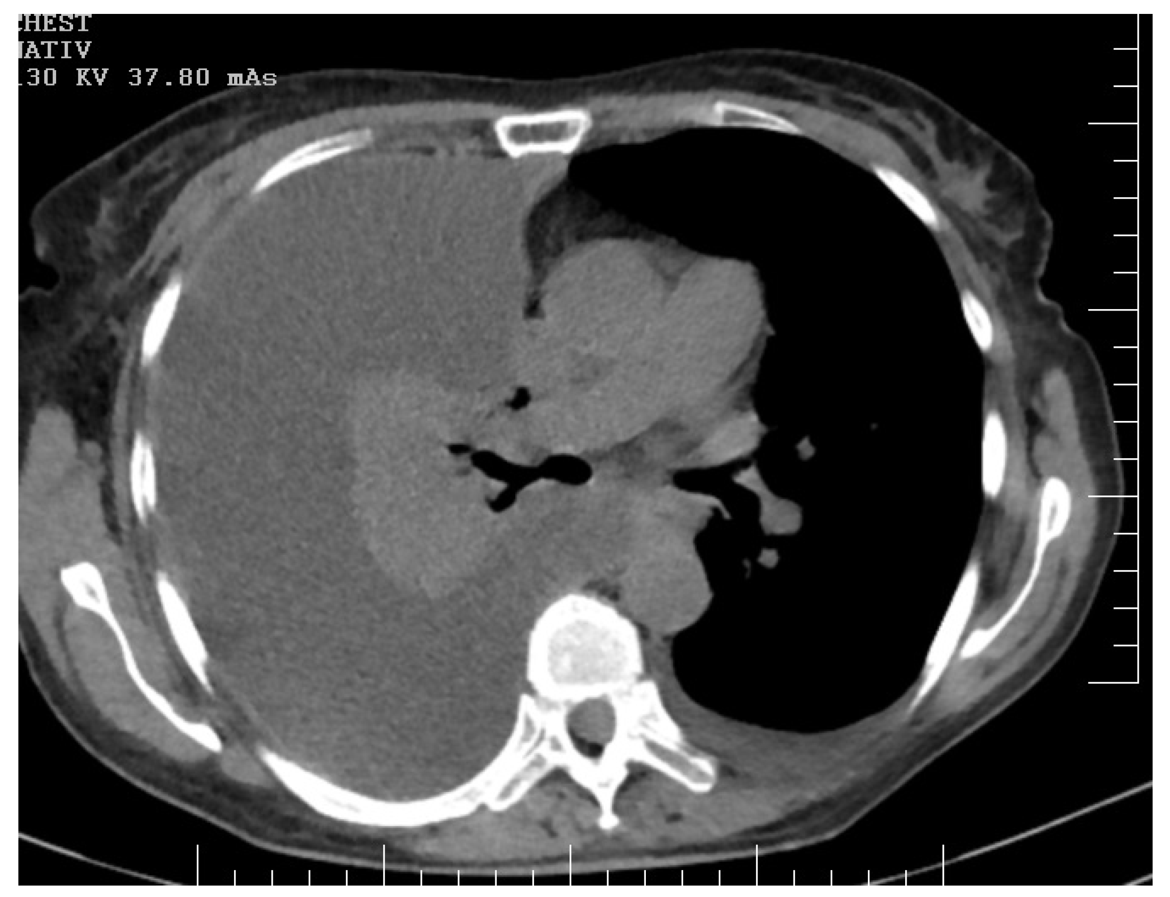 Diagnostics 14 00455 g003 Diagnostics 14 00455 g003