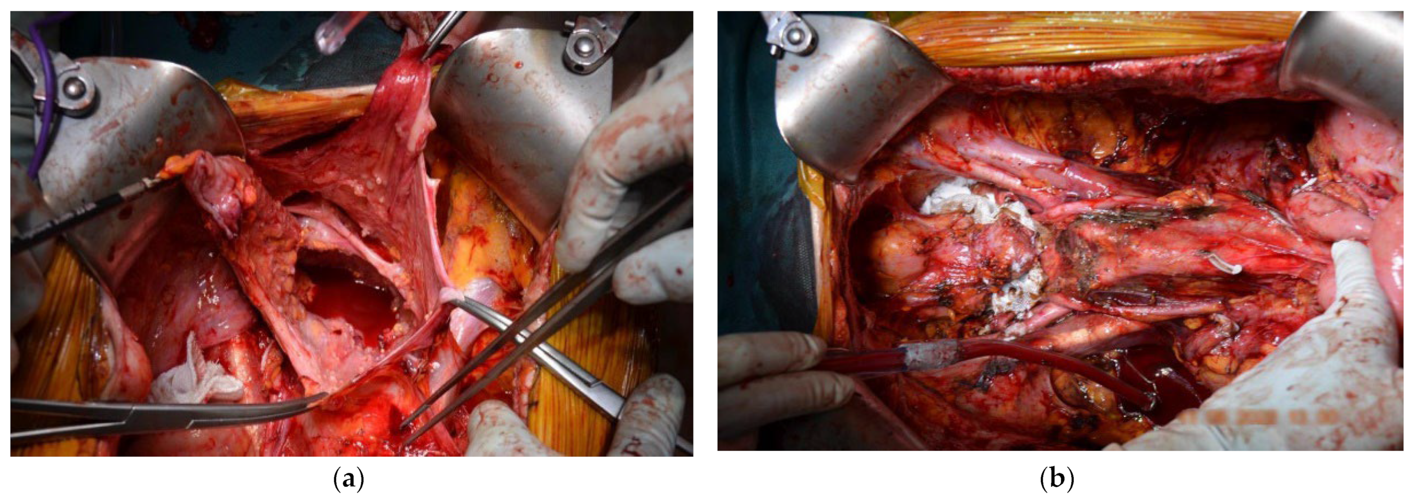 Diagnostics 14 00455 g007 Diagnostics 14 00455 g007