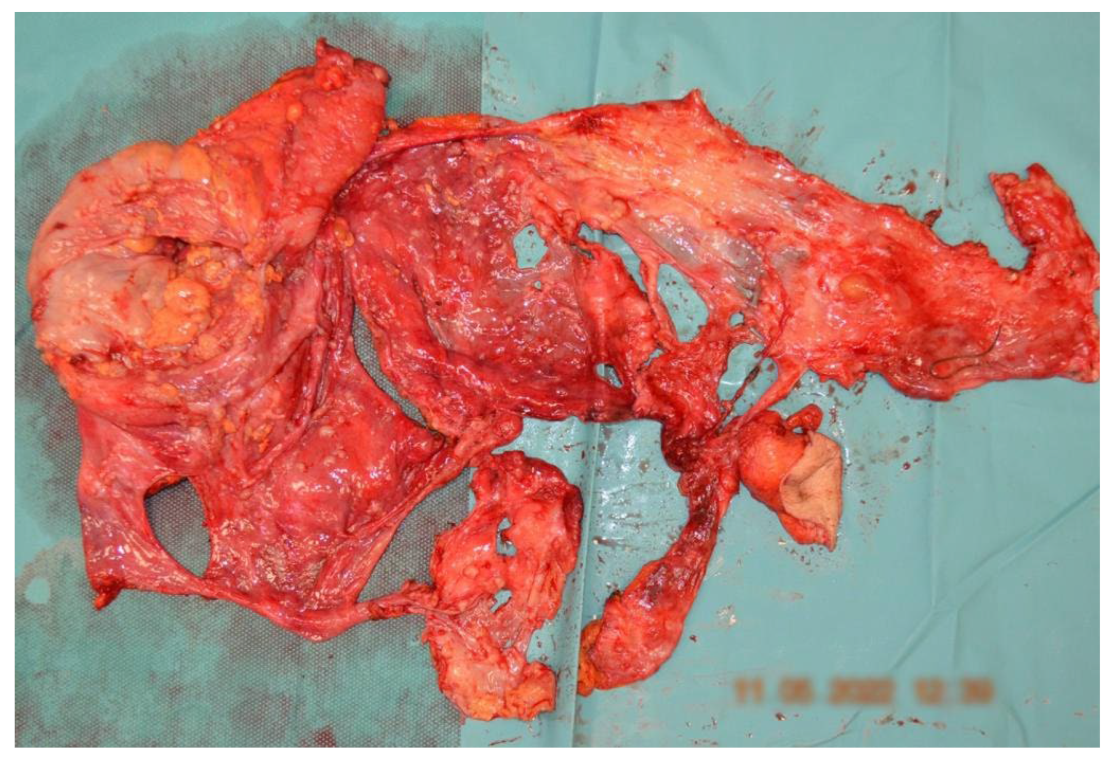 Diagnostics 14 00455 g008 Diagnostics 14 00455 g008