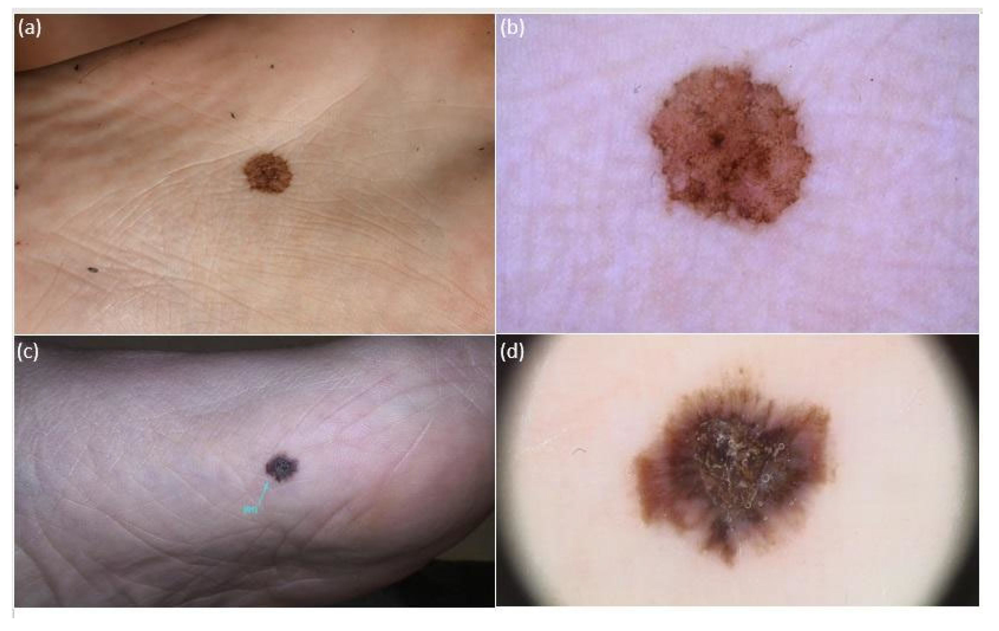 Diagnostics 14 00460 g002