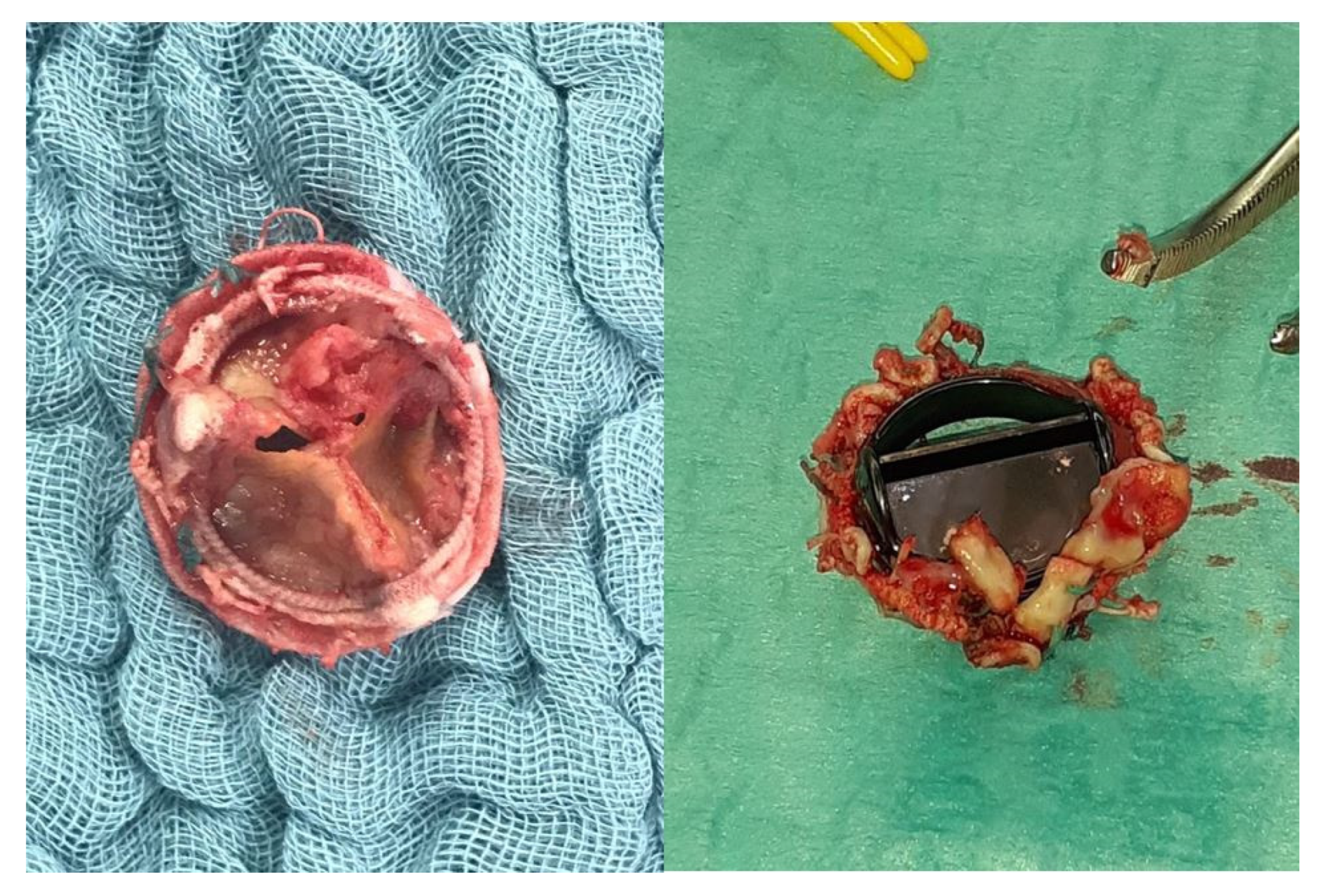 Diagnostics 14 00464 g002 Diagnostics 14 00464 g002